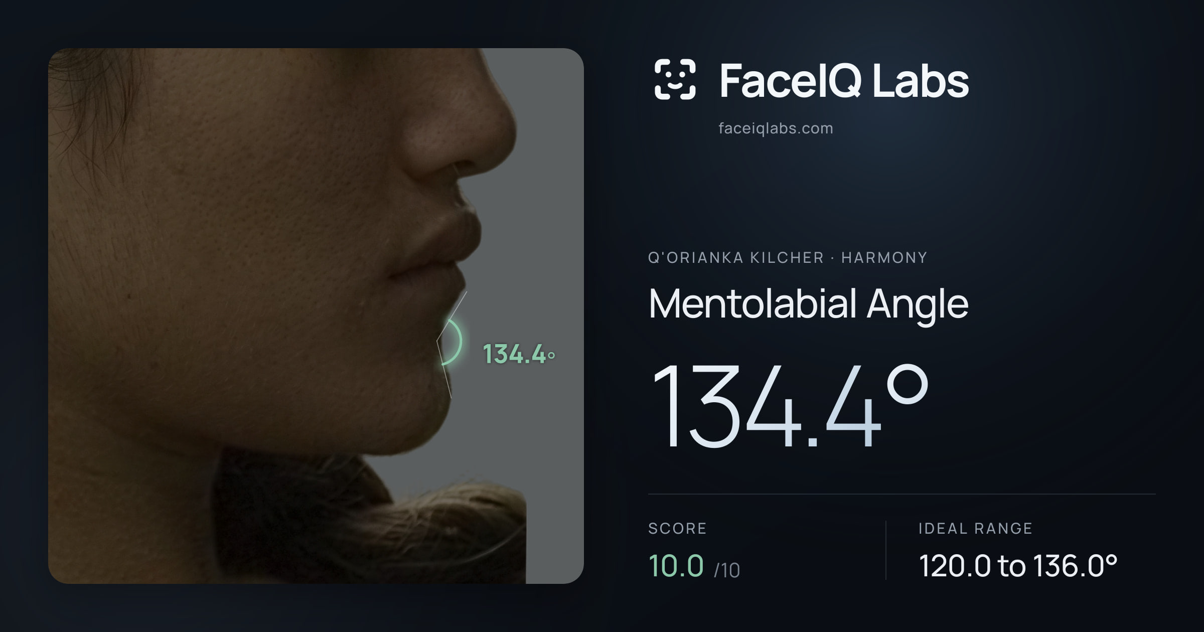Q'orianka Kilcher Mentolabial Angle: 134.4°, drawn on the photo