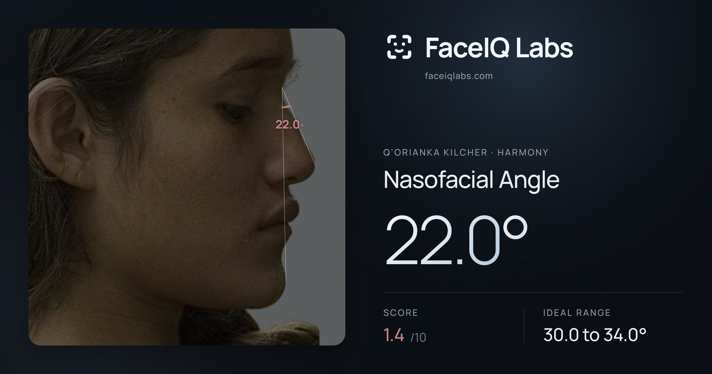 Q'orianka Kilcher Nasofacial Angle: 22.0°, drawn on the photo