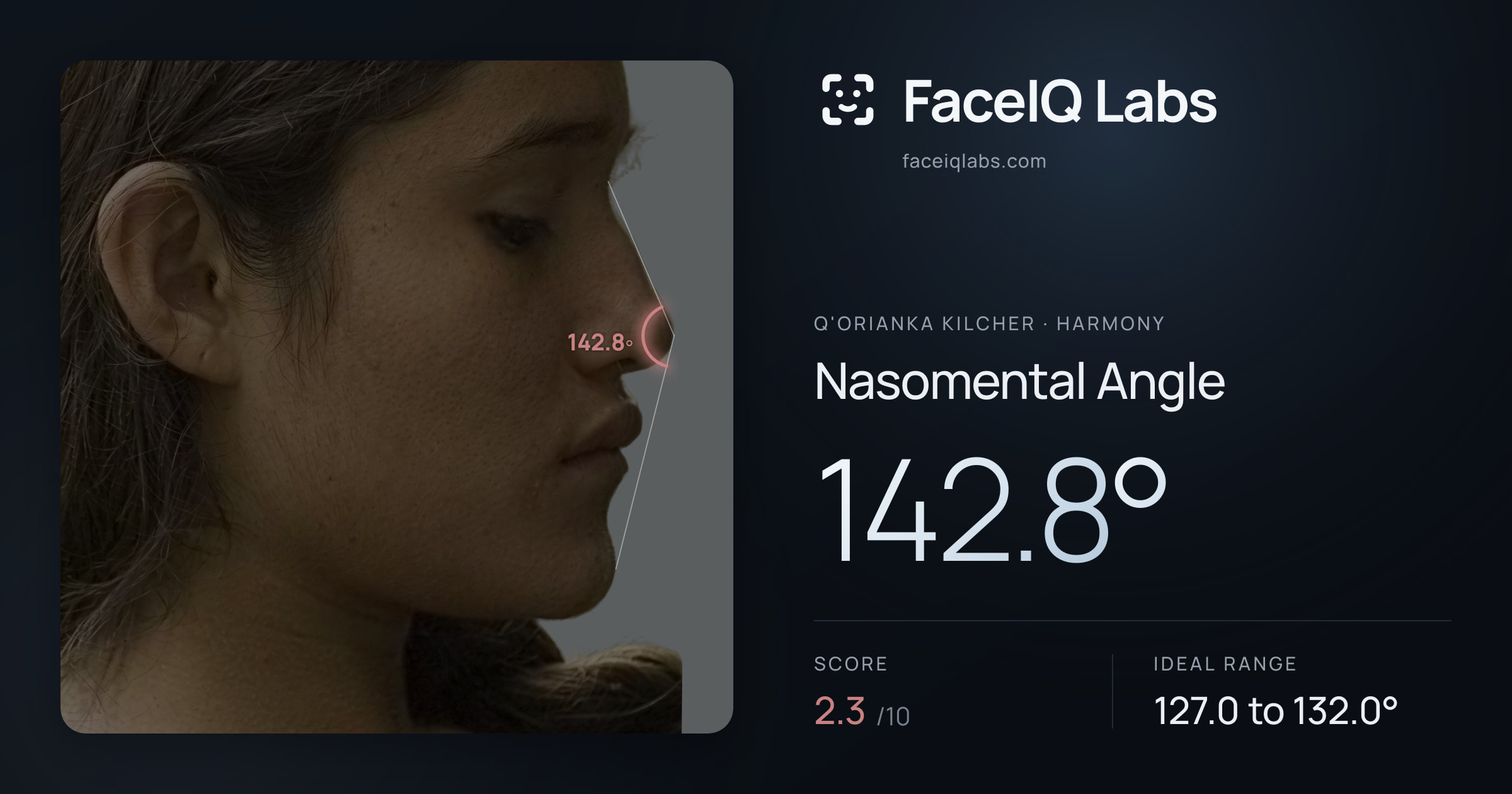 Q'orianka Kilcher Nasomental Angle: 142.8°, drawn on the photo