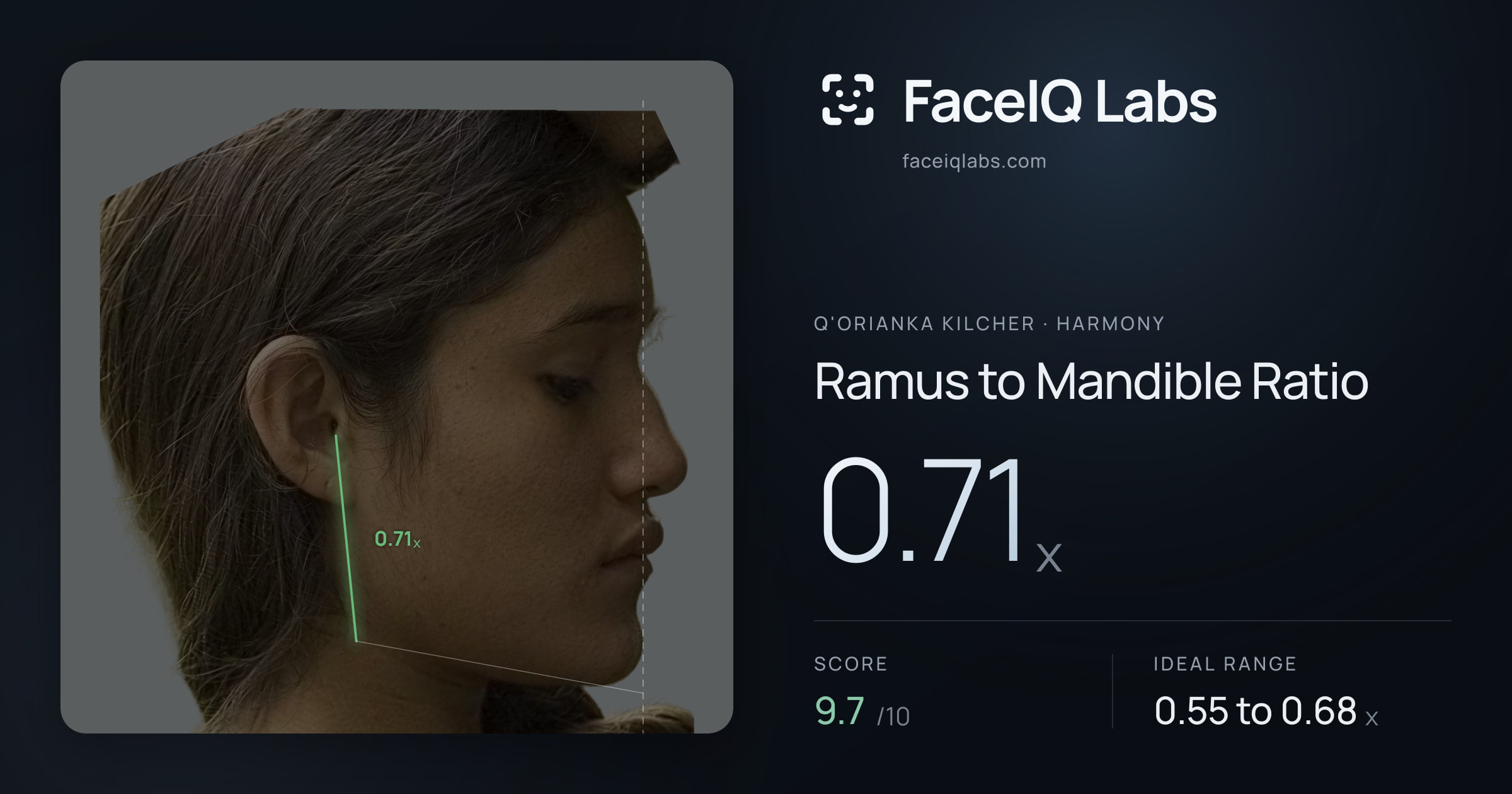 Q'orianka Kilcher Ramus to Mandible Ratio: 0.71x, drawn on the photo