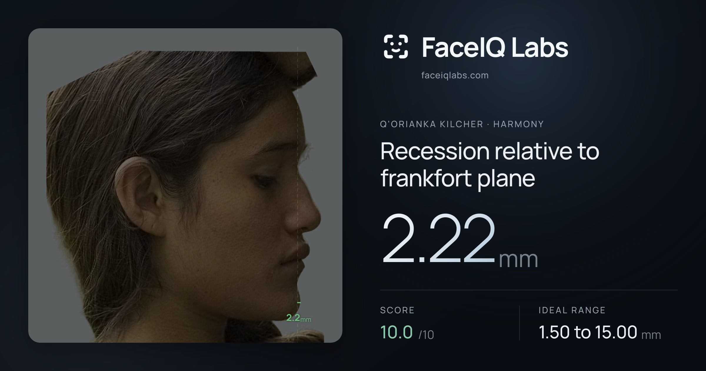 Q'orianka Kilcher Recession relative to frankfort plane: 2.22mm, drawn on the photo