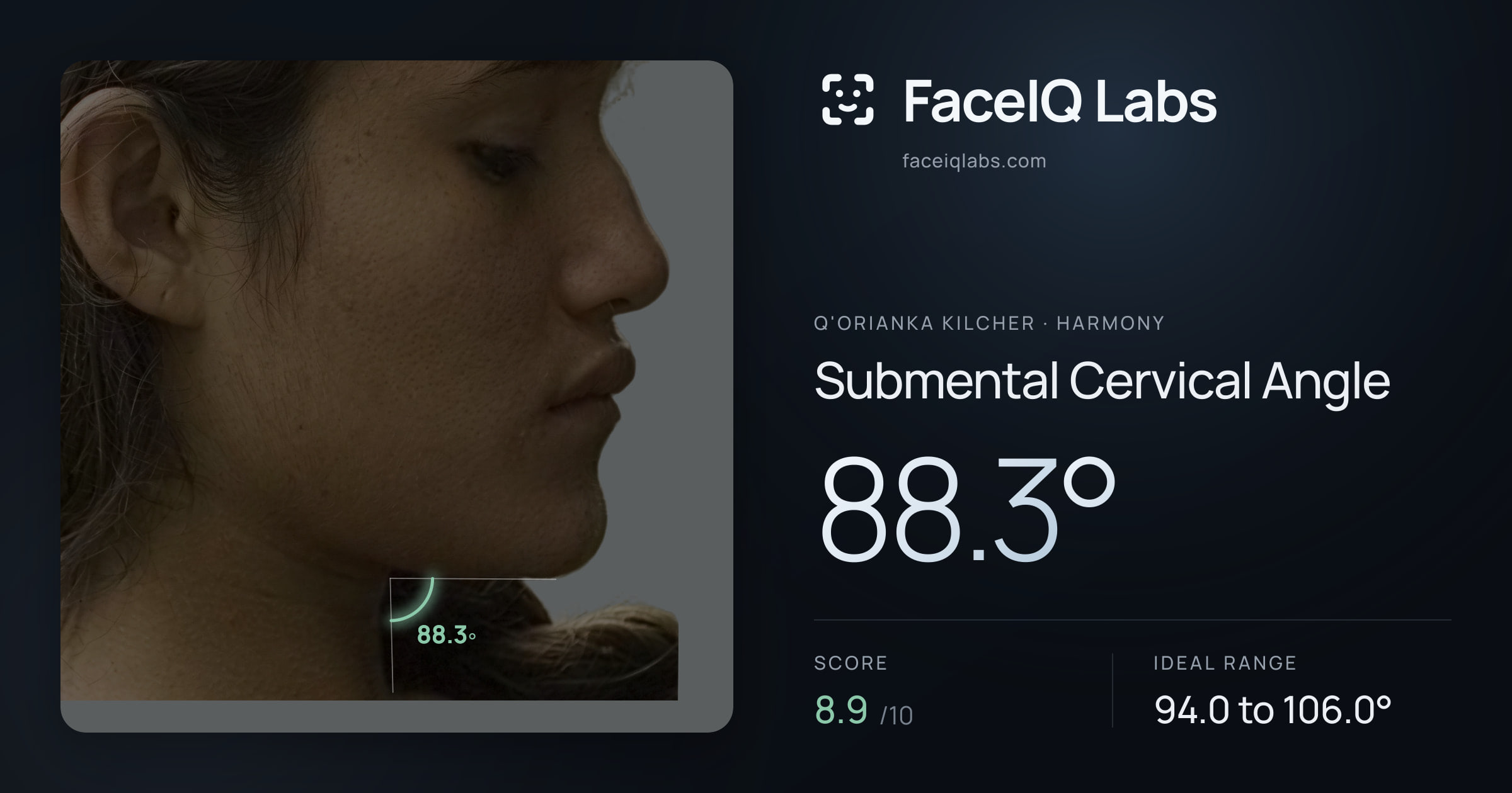 Q'orianka Kilcher Submental Cervical Angle: 88.3°, drawn on the photo
