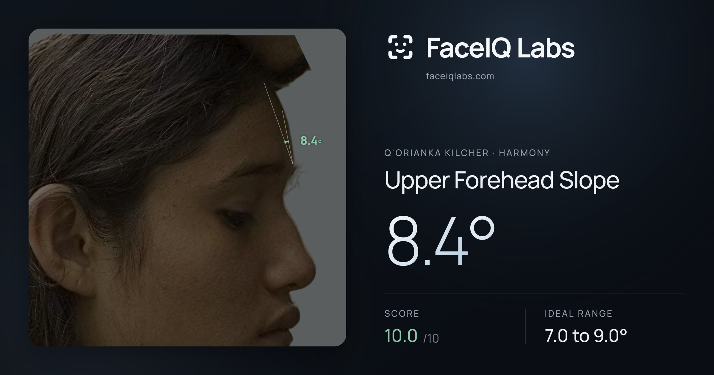 Q'orianka Kilcher Upper Forehead Slope: 8.4°, drawn on the photo