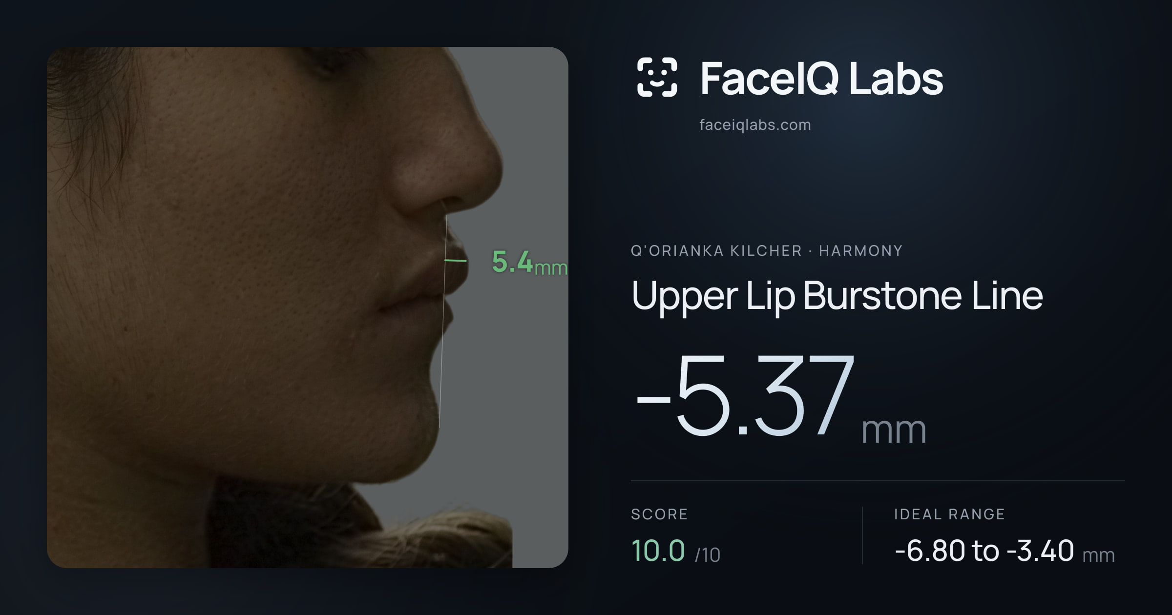 Q'orianka Kilcher Upper Lip Burstone Line: -5.37mm, drawn on the photo
