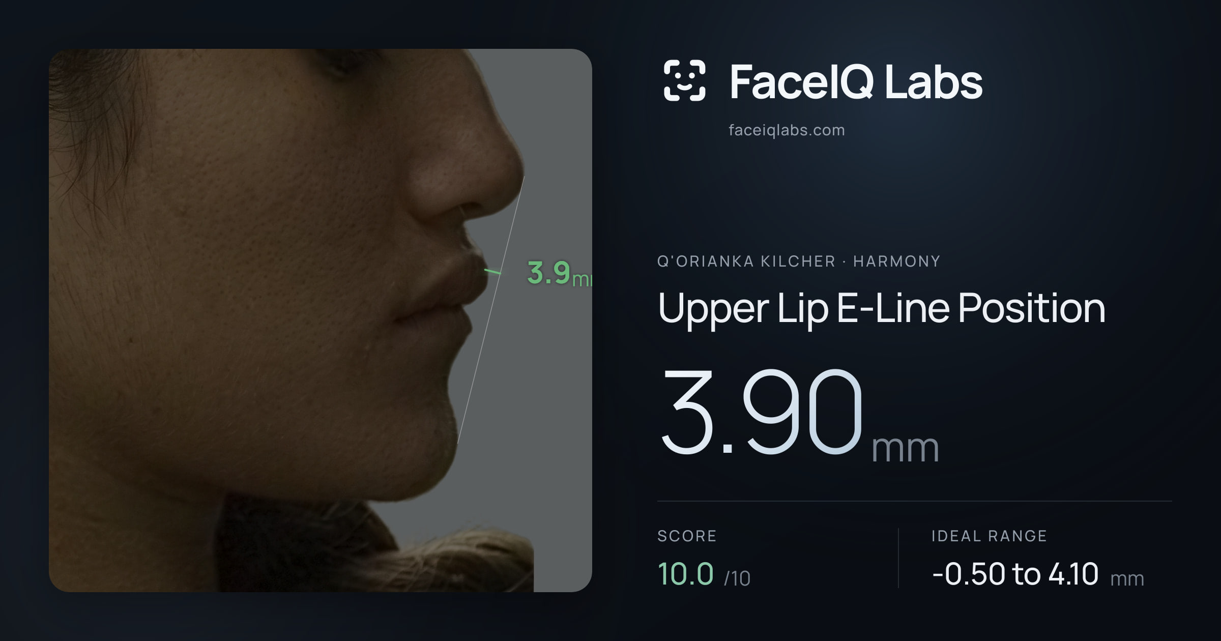 Q'orianka Kilcher Upper Lip E-Line Position: 3.90mm, drawn on the photo