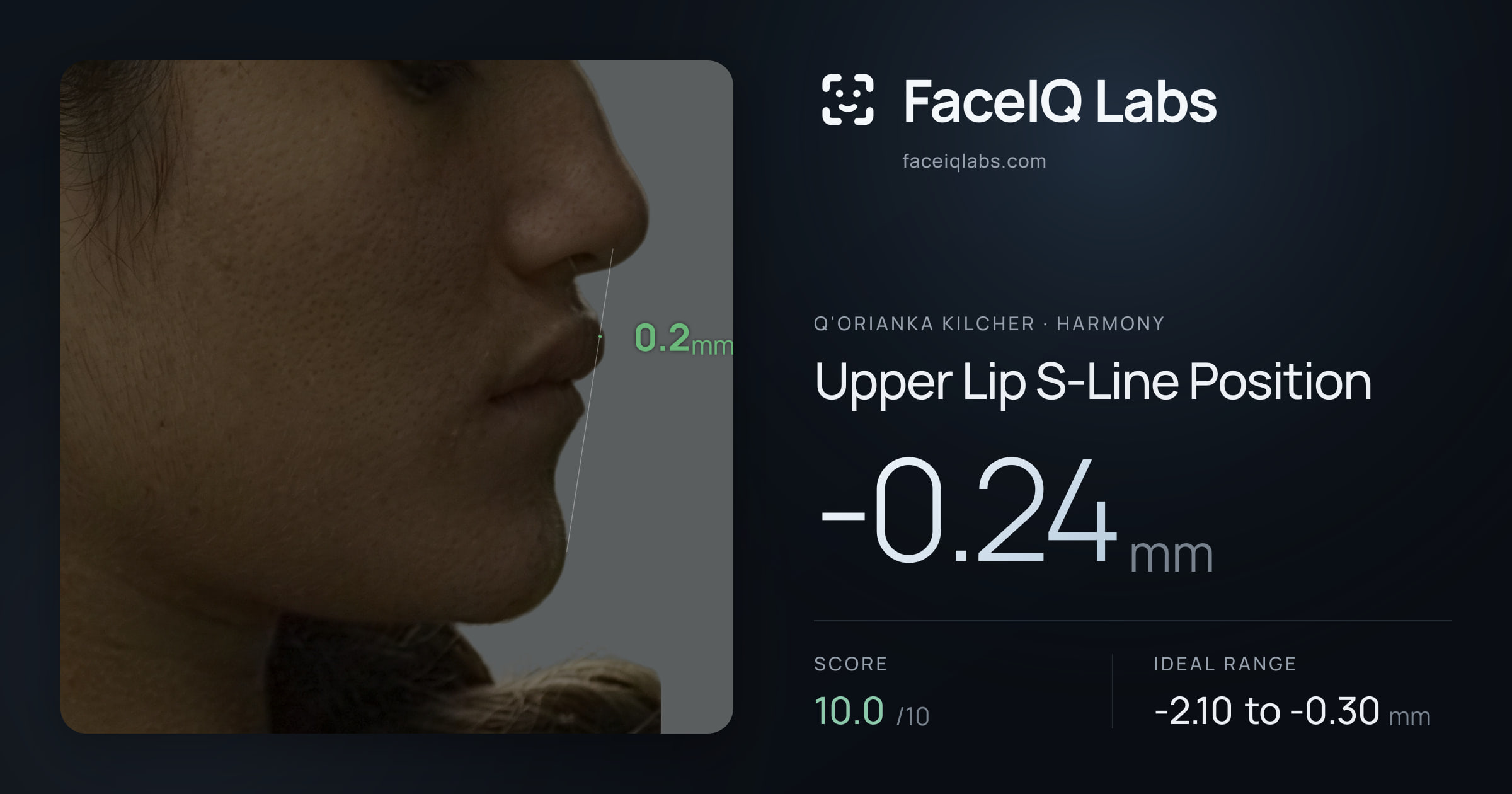 Q'orianka Kilcher Upper Lip S-Line Position: -0.24mm, drawn on the photo