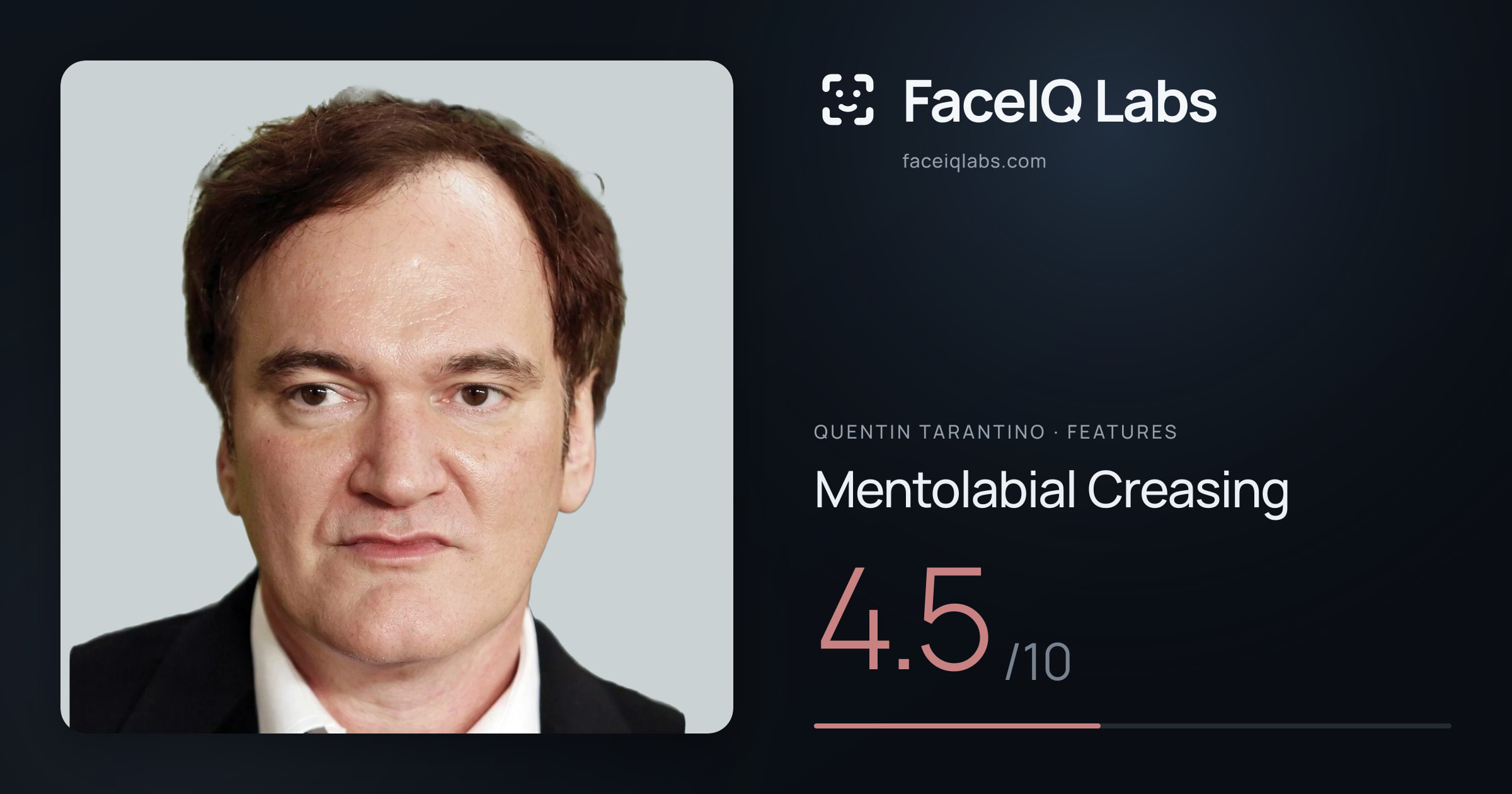 Quentin Tarantino Mentolabial Creasing: 4.5/10, drawn on the photo