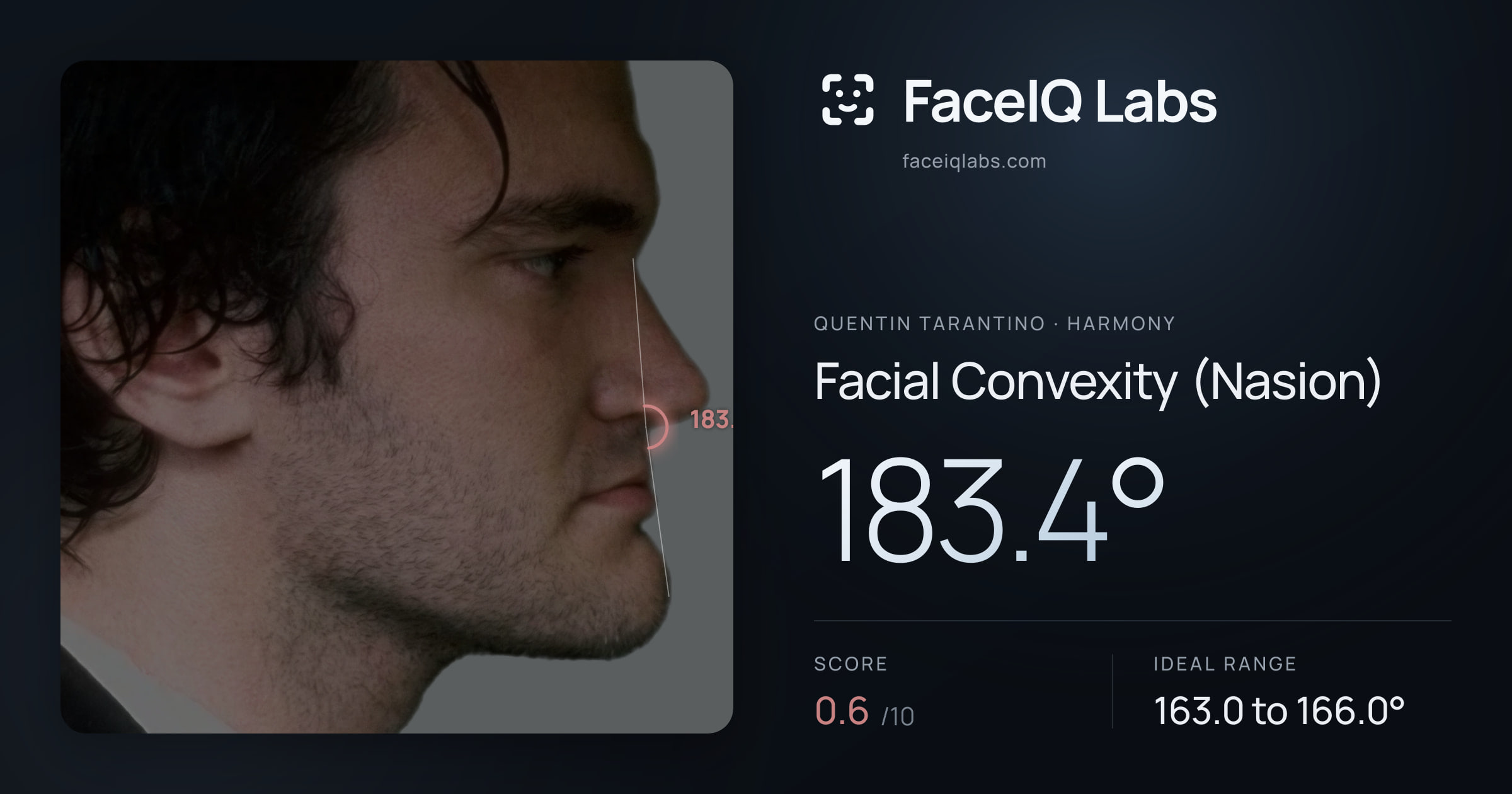 Quentin Tarantino Facial Convexity (Nasion): 183.4°, drawn on the photo