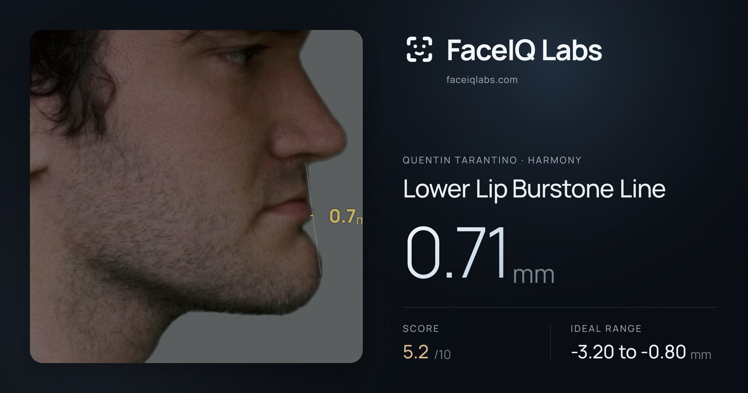 Quentin Tarantino Lower Lip Burstone Line: 0.71mm, drawn on the photo