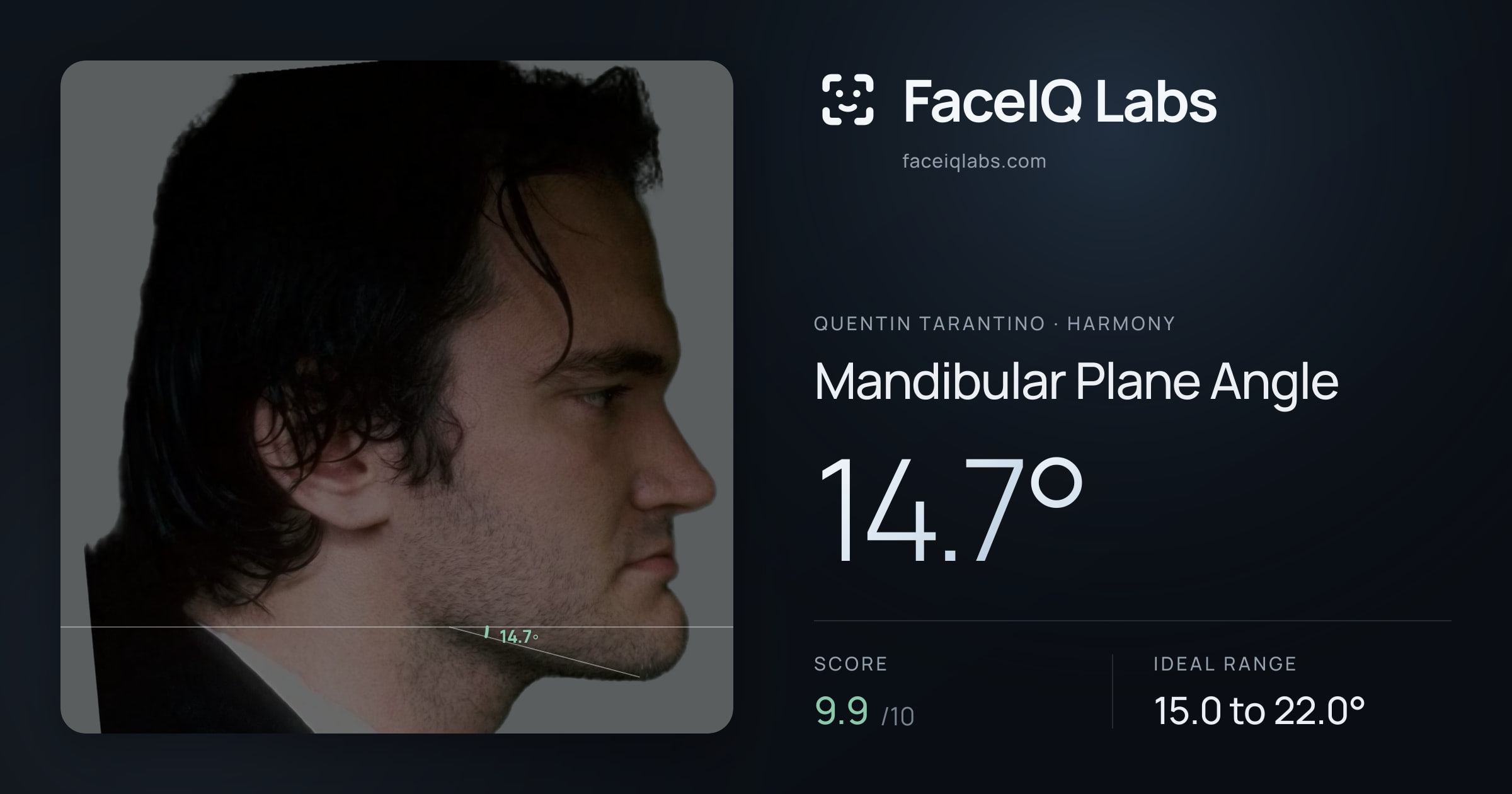 Quentin Tarantino Mandibular Plane Angle: 14.7°, drawn on the photo