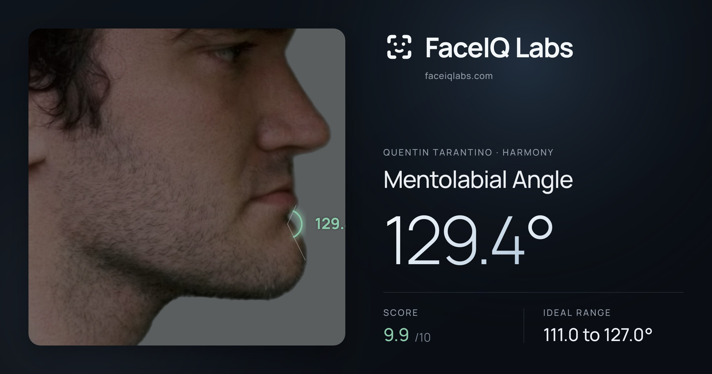 Quentin Tarantino Mentolabial Angle: 129.4°, drawn on the photo