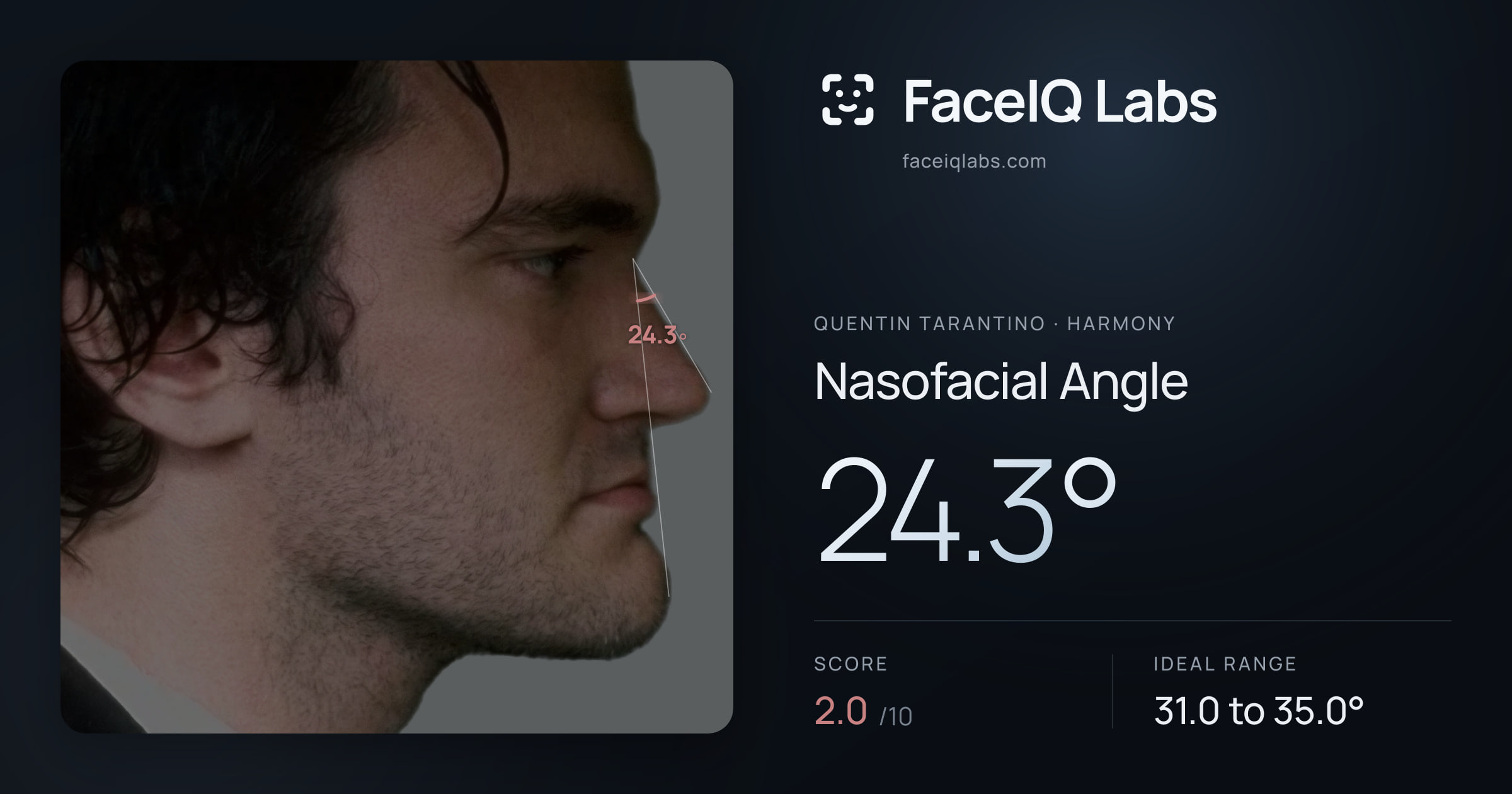 Quentin Tarantino Nasofacial Angle: 24.3°, drawn on the photo