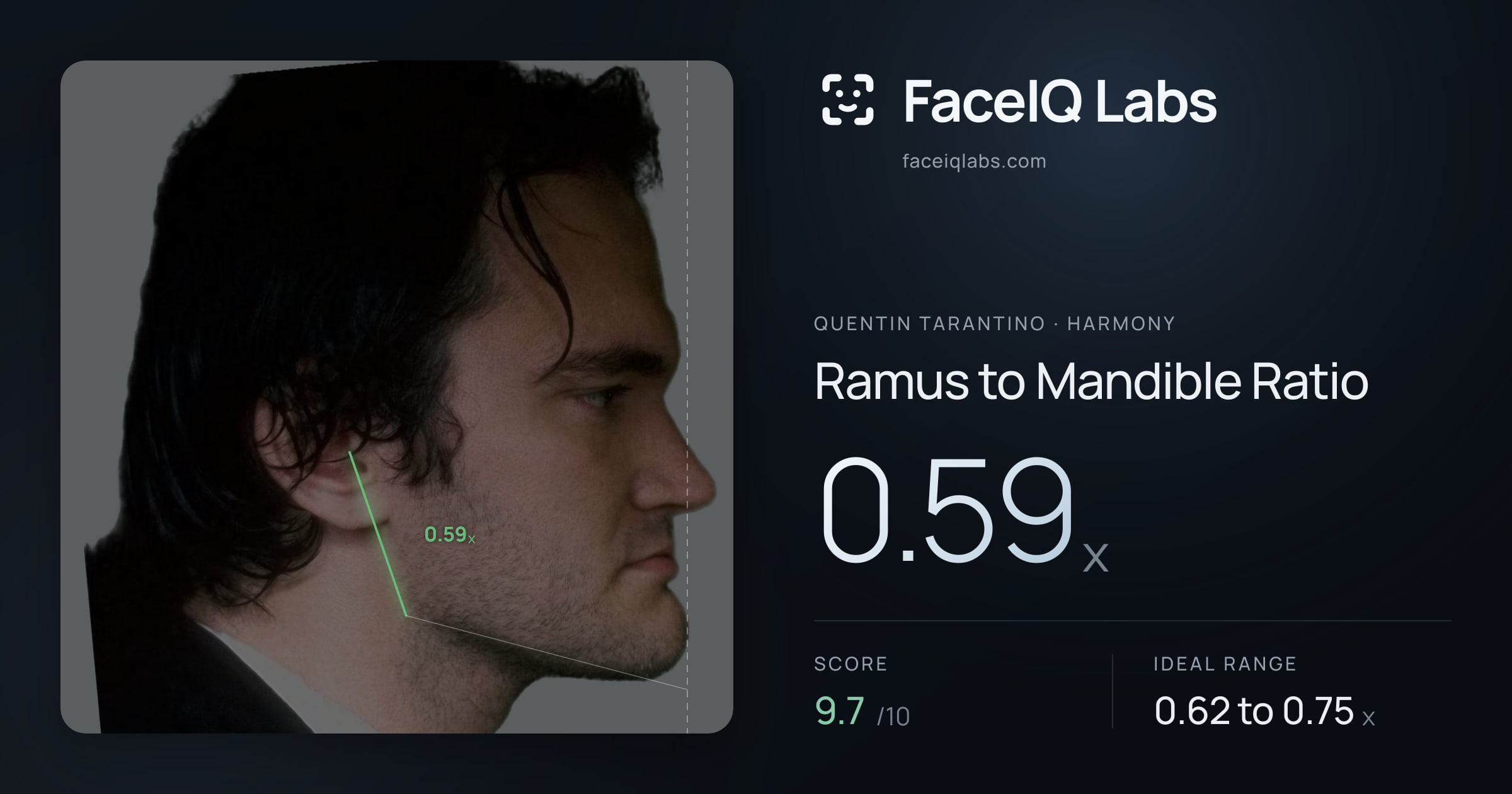 Quentin Tarantino Ramus to Mandible Ratio: 0.59x, drawn on the photo