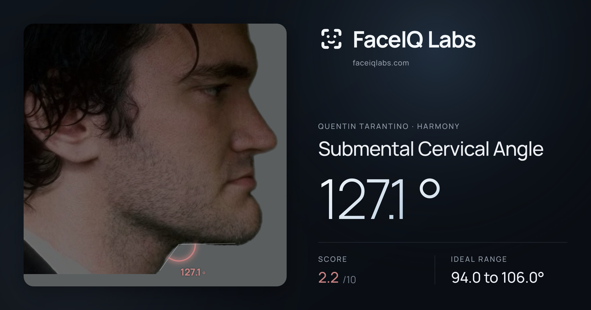 Quentin Tarantino Submental Cervical Angle: 127.1°, drawn on the photo