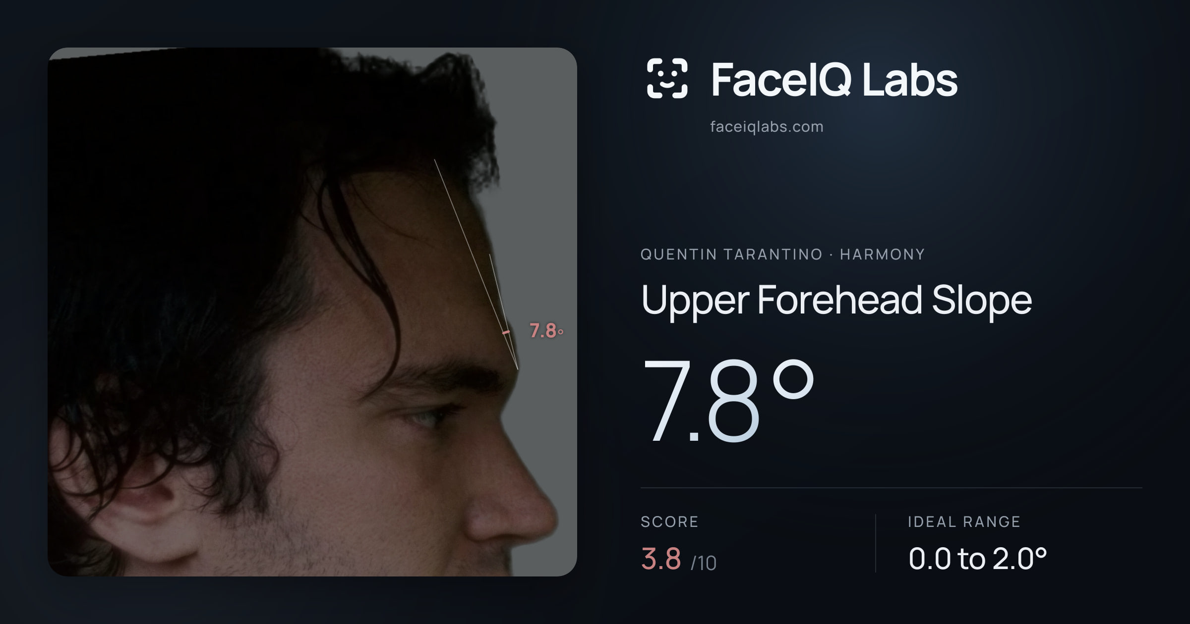 Quentin Tarantino Upper Forehead Slope: 7.8°, drawn on the photo