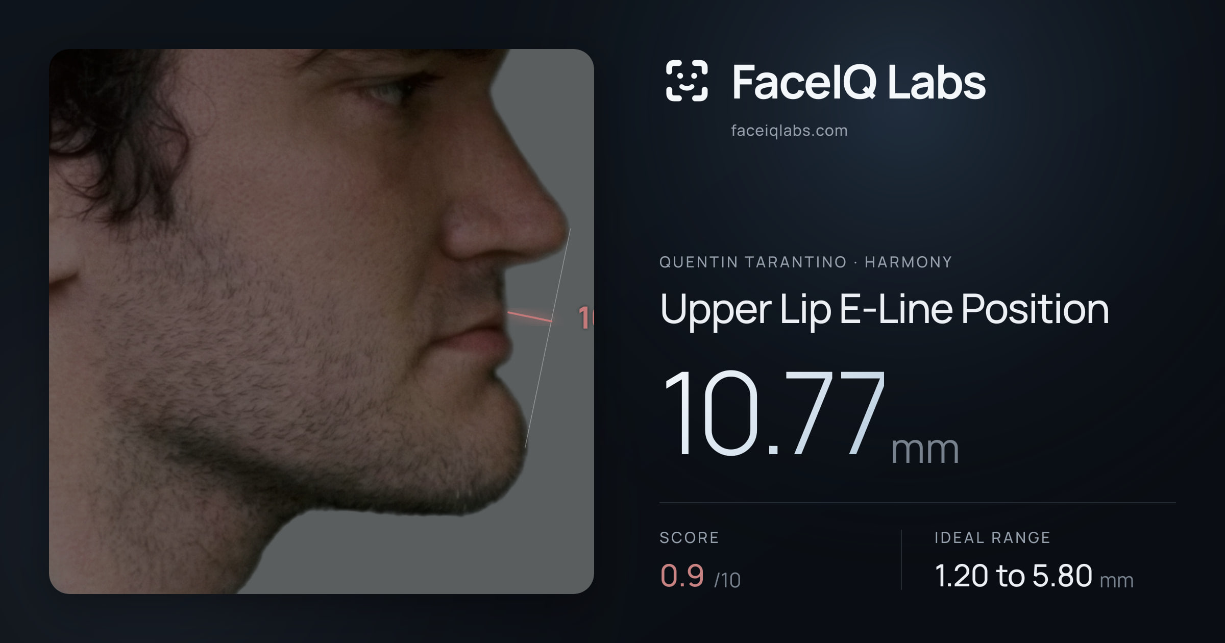 Quentin Tarantino Upper Lip E-Line Position: 10.77mm, drawn on the photo