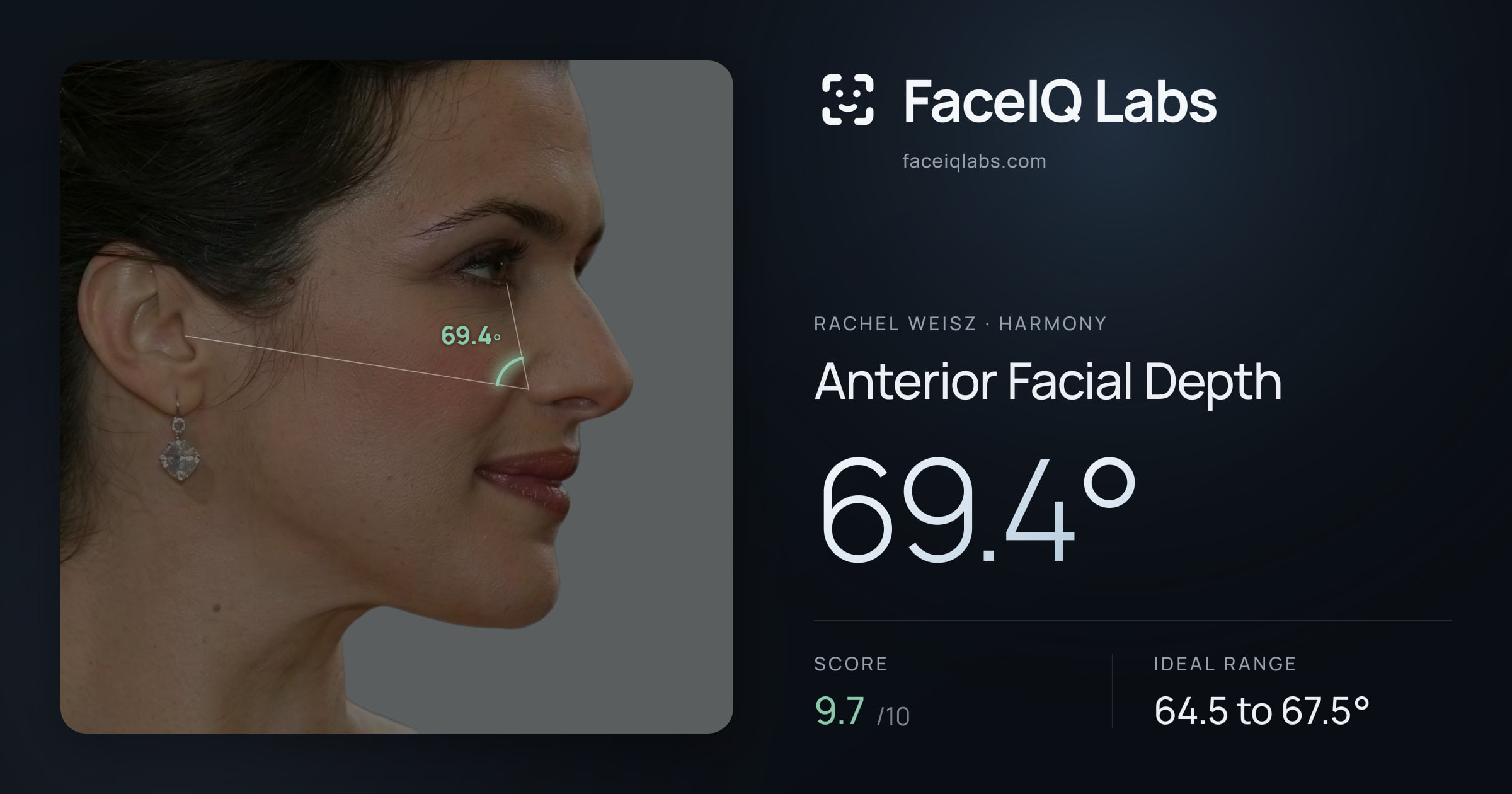 Rachel Weisz Anterior Facial Depth: 69.4°, drawn on the photo
