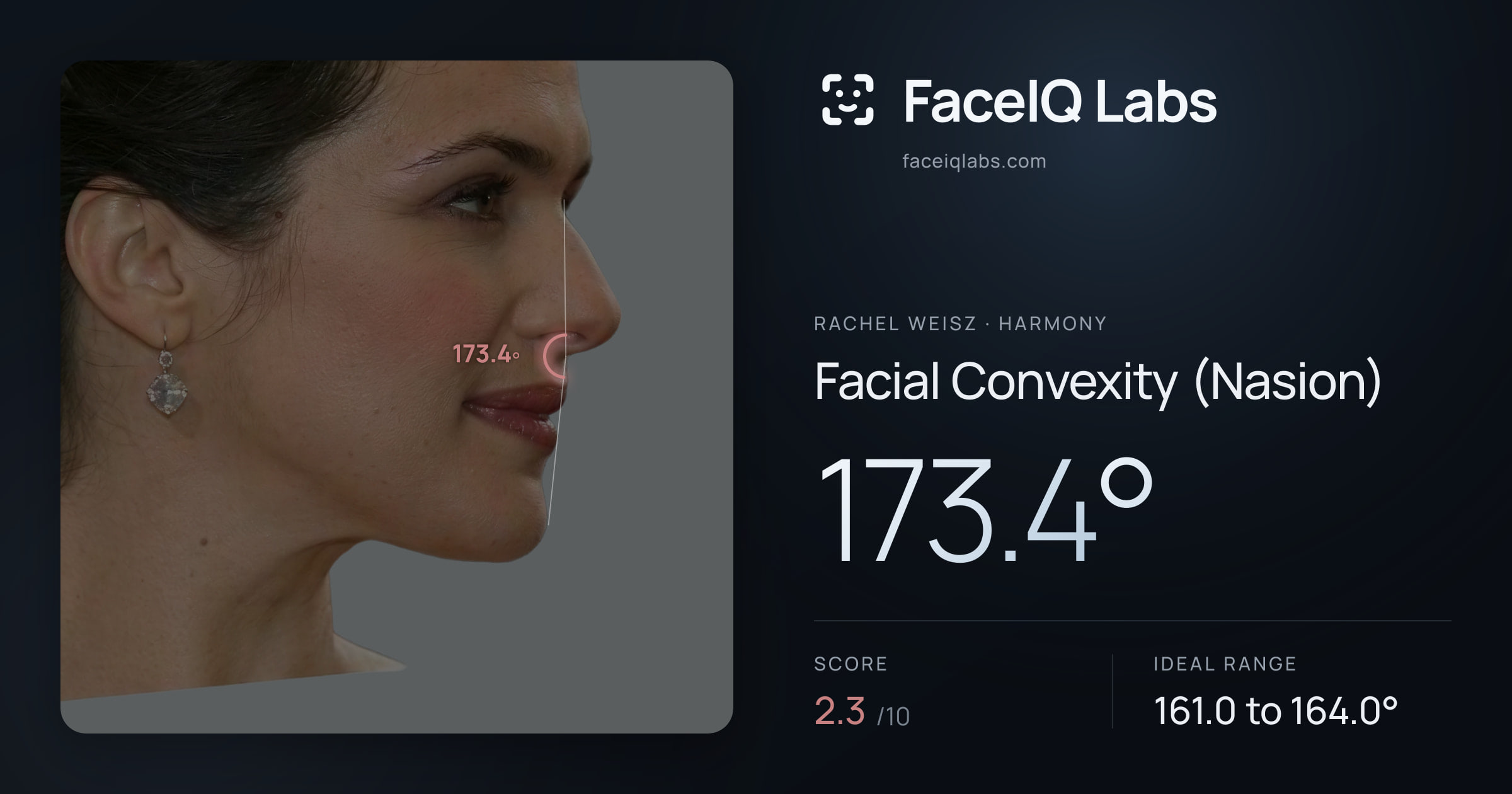 Rachel Weisz Facial Convexity (Nasion): 173.4°, drawn on the photo