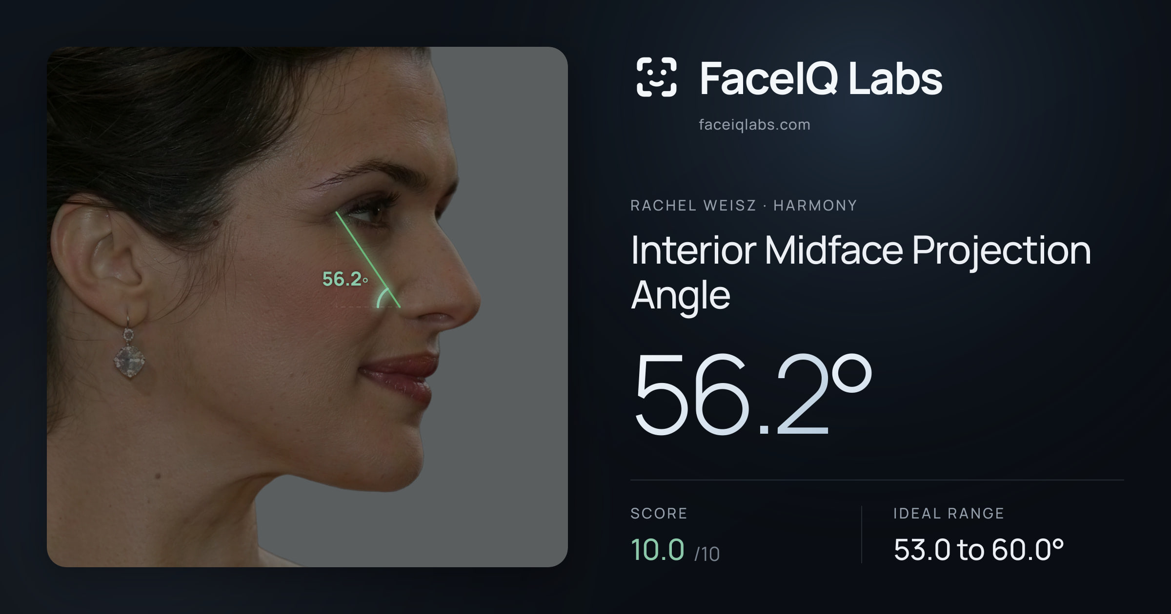 Rachel Weisz Interior Midface Projection Angle: 56.2°, drawn on the photo