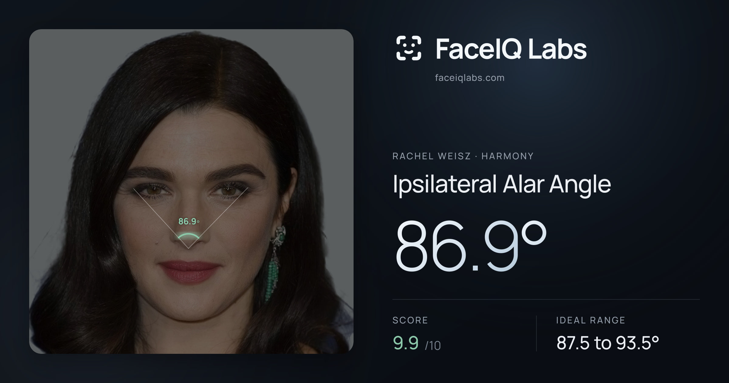 Rachel Weisz Ipsilateral Alar Angle: 86.9°, drawn on the photo