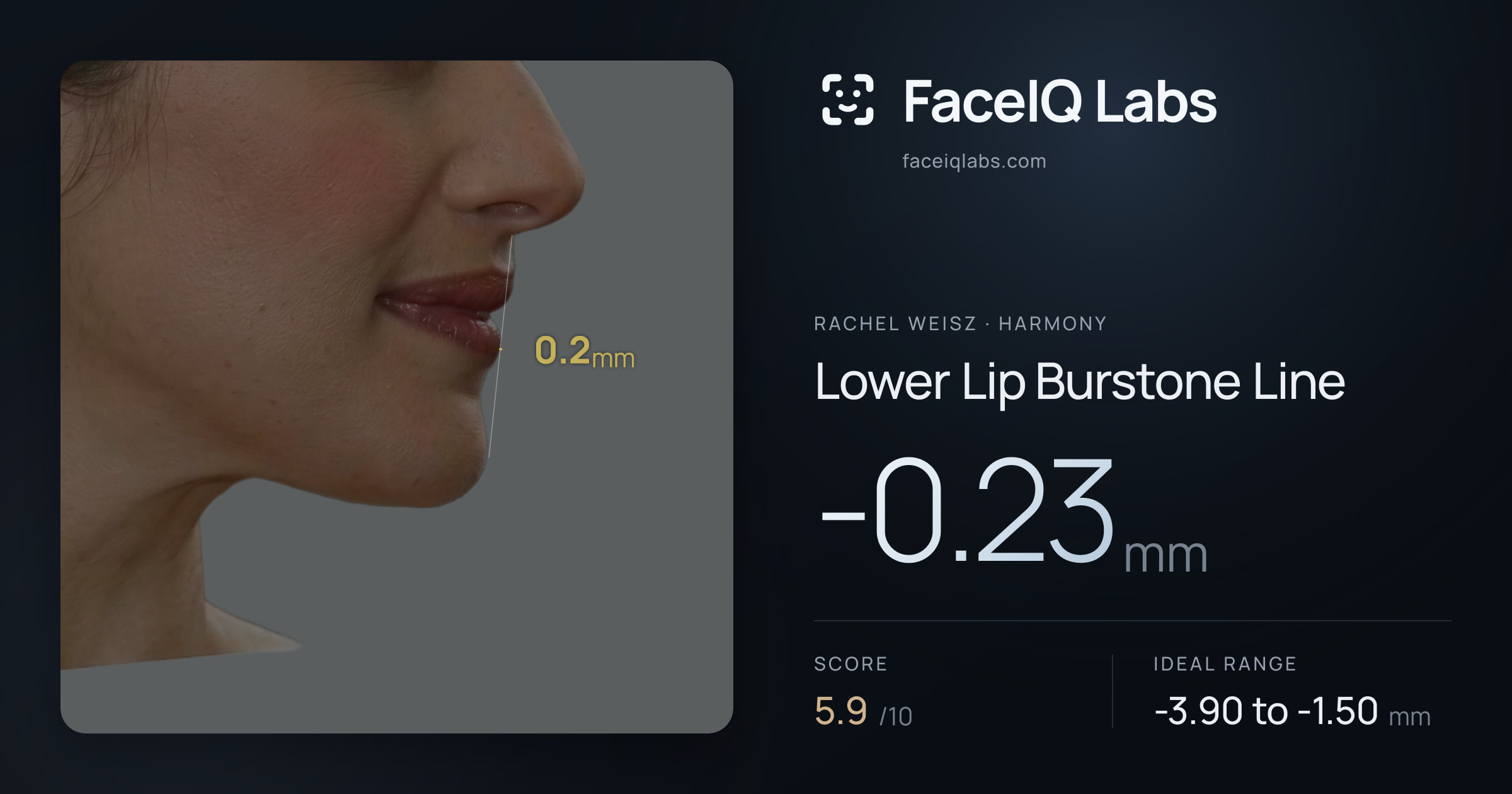 Rachel Weisz Lower Lip Burstone Line: -0.23mm, drawn on the photo