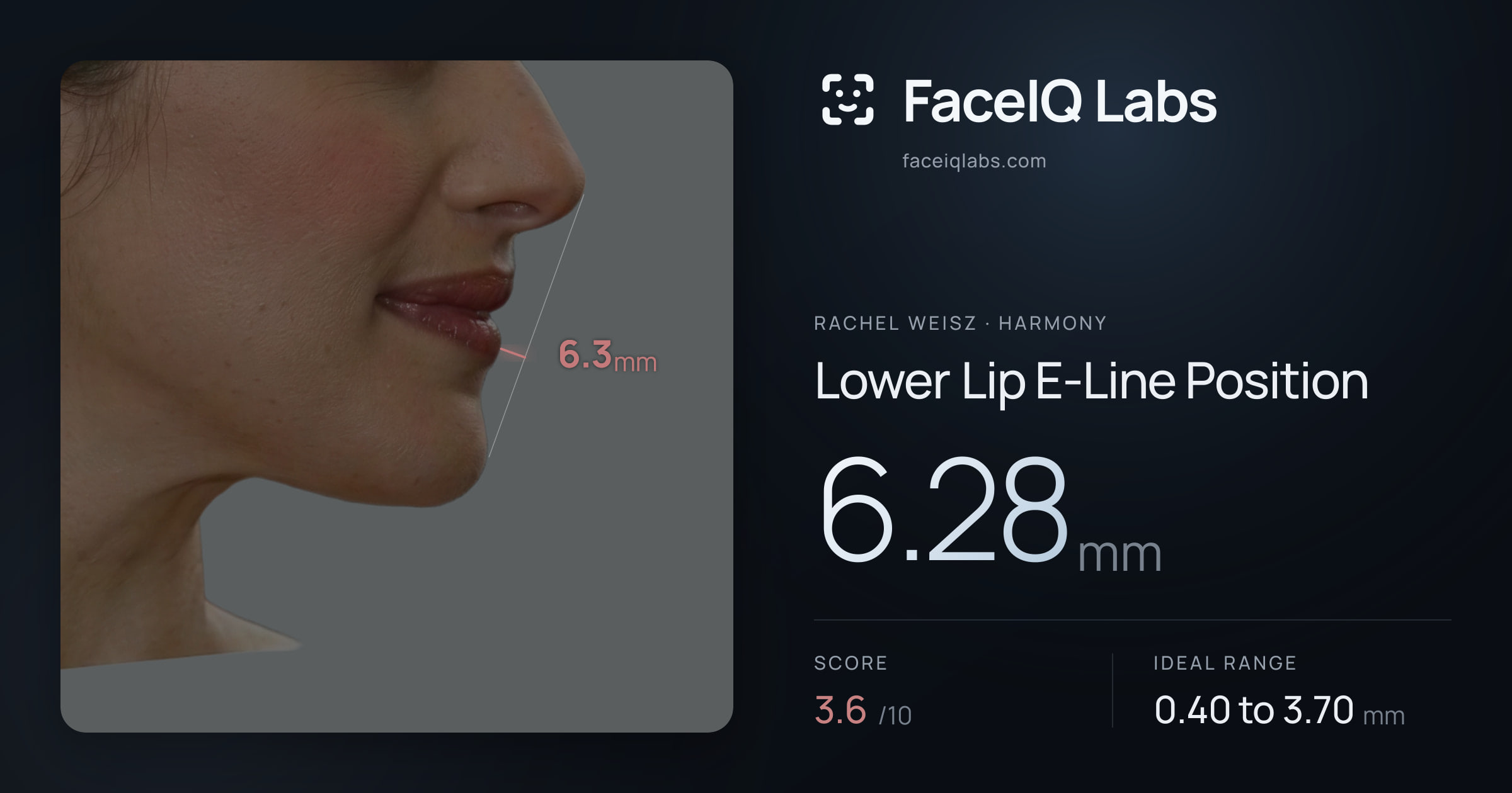 Rachel Weisz Lower Lip E-Line Position: 6.28mm, drawn on the photo