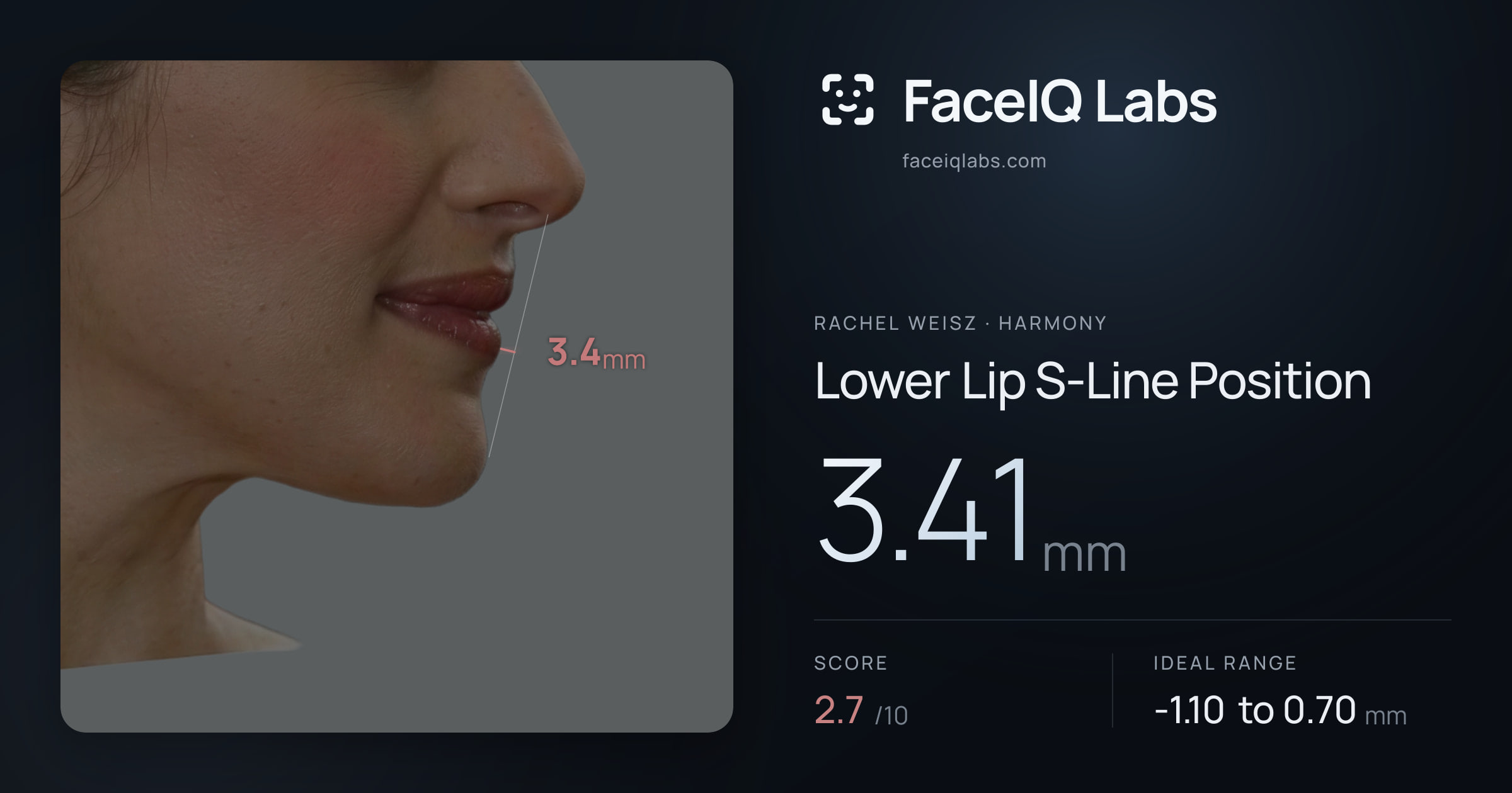 Rachel Weisz Lower Lip S-Line Position: 3.41mm, drawn on the photo