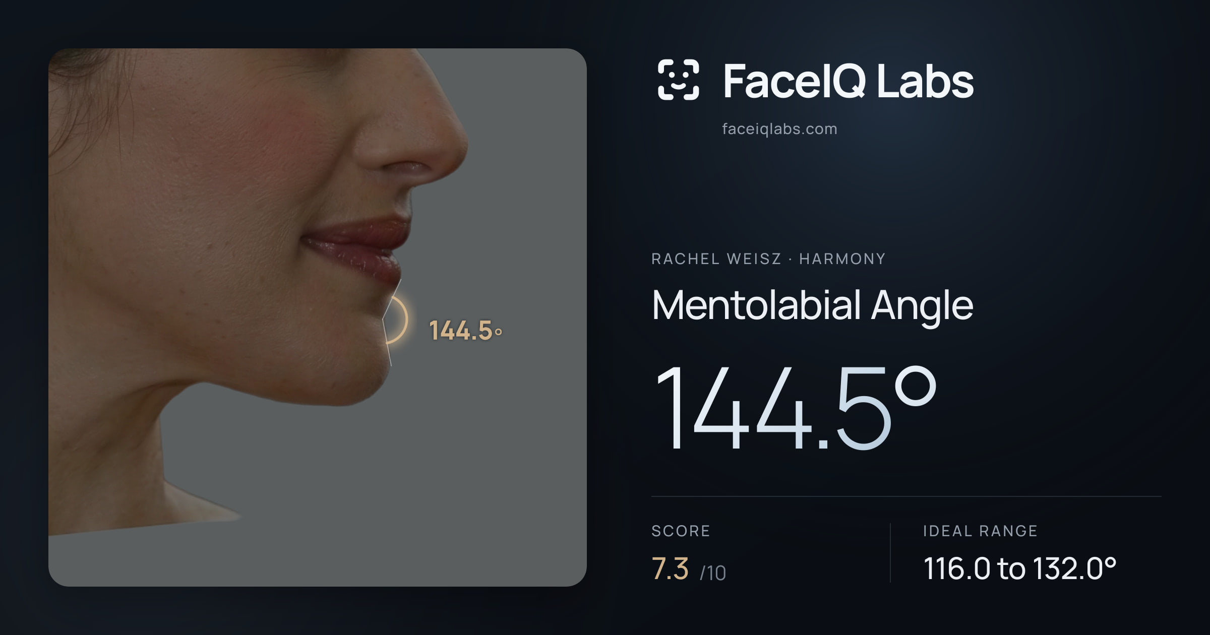 Rachel Weisz Mentolabial Angle: 144.5°, drawn on the photo