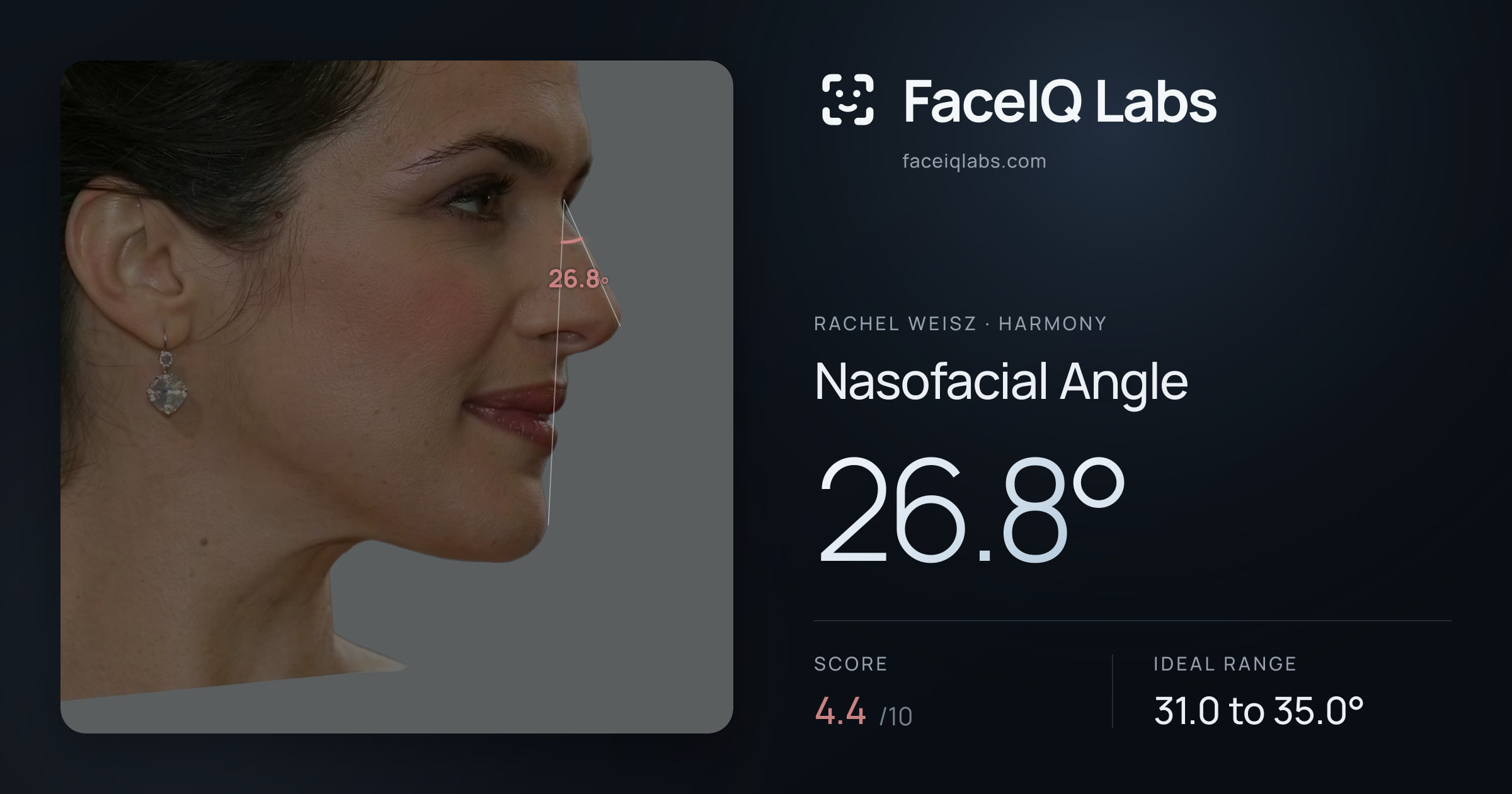 Rachel Weisz Nasofacial Angle: 26.8°, drawn on the photo