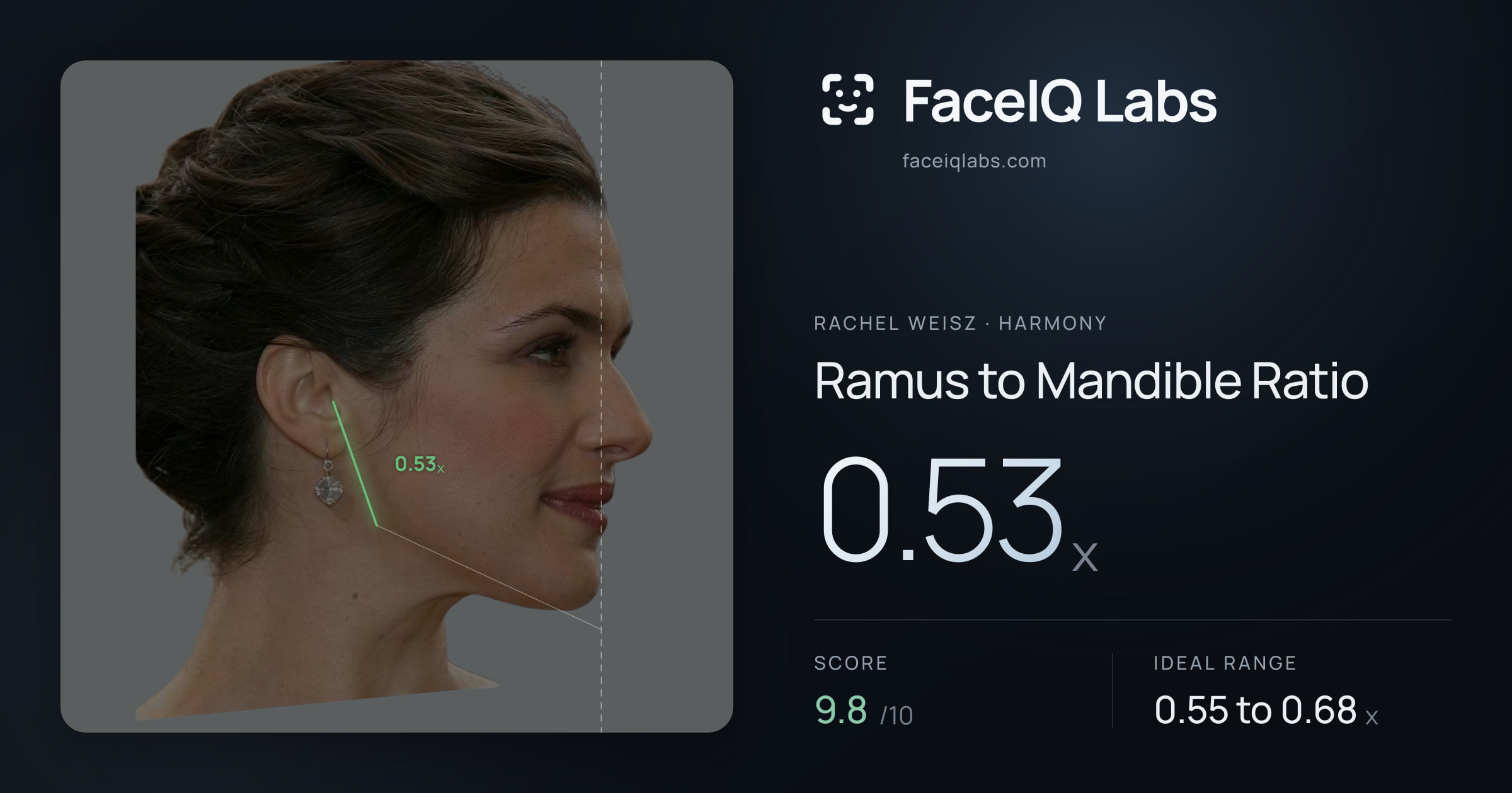 Rachel Weisz Ramus to Mandible Ratio: 0.53x, drawn on the photo