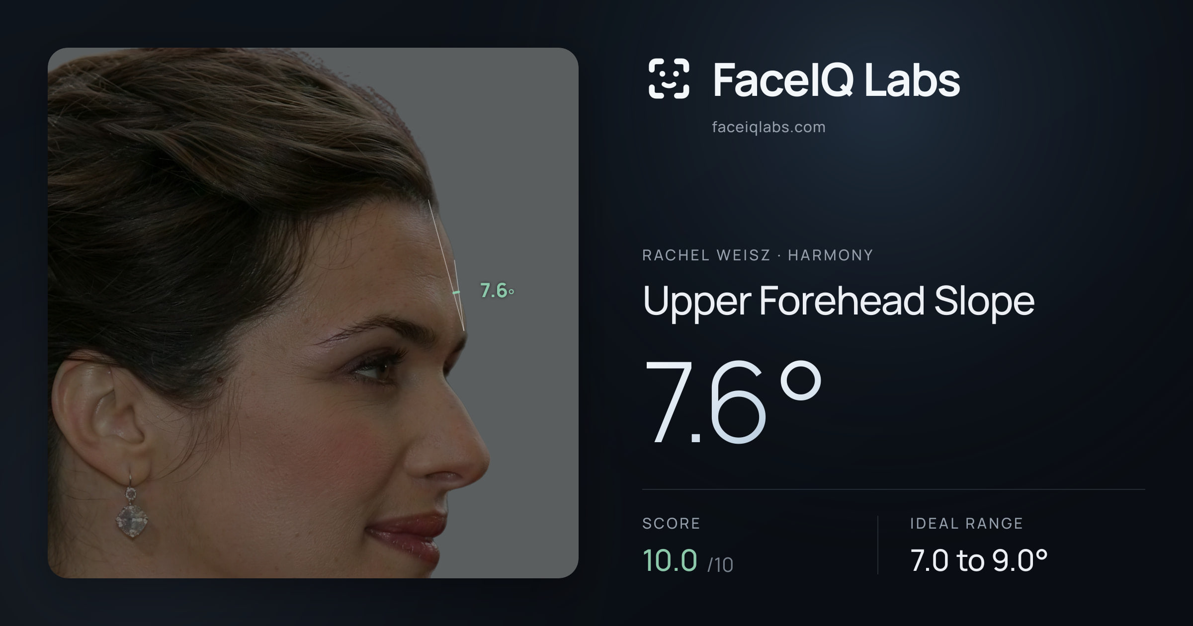 Rachel Weisz Upper Forehead Slope: 7.6°, drawn on the photo