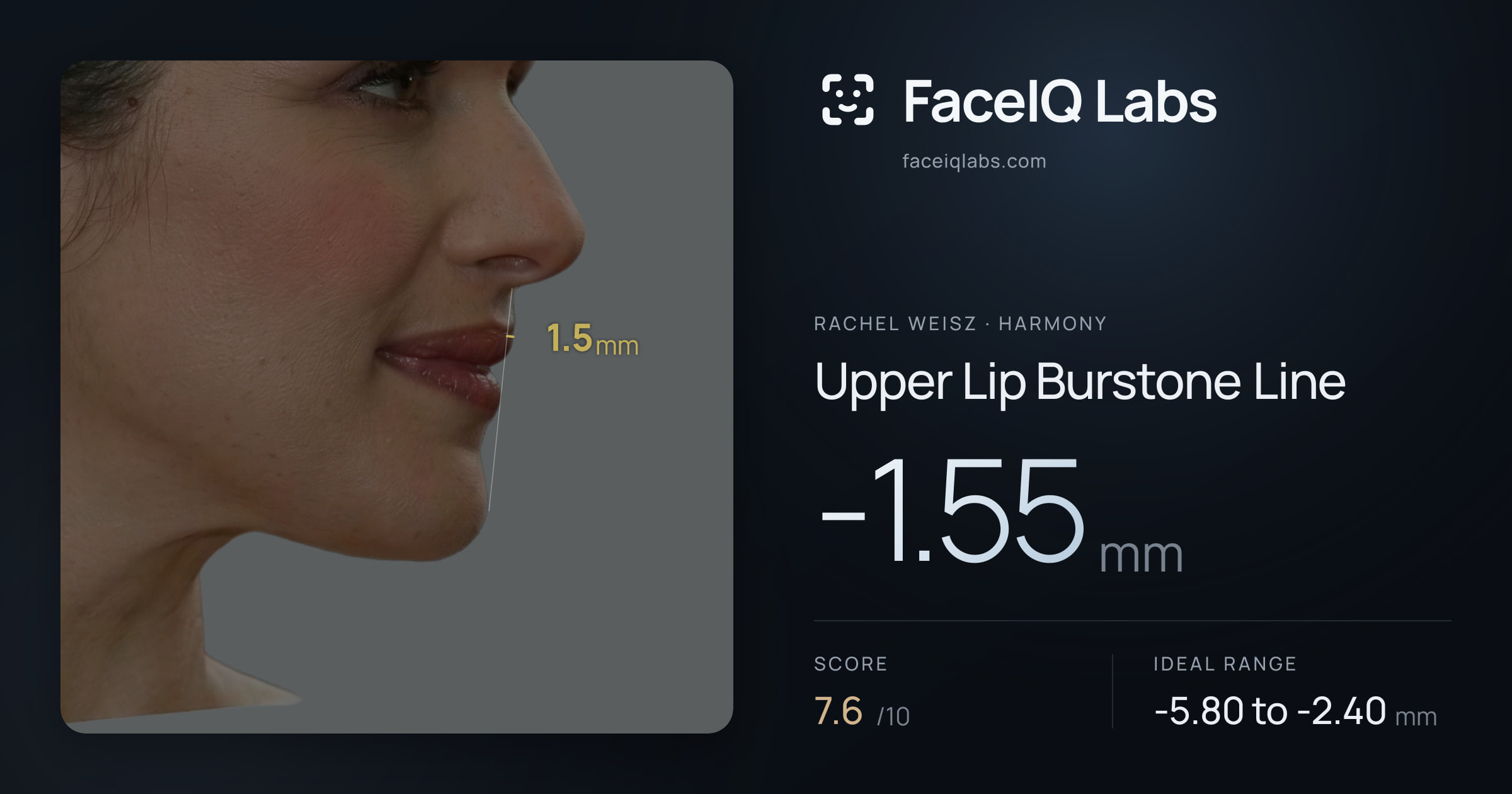 Rachel Weisz Upper Lip Burstone Line: -1.55mm, drawn on the photo