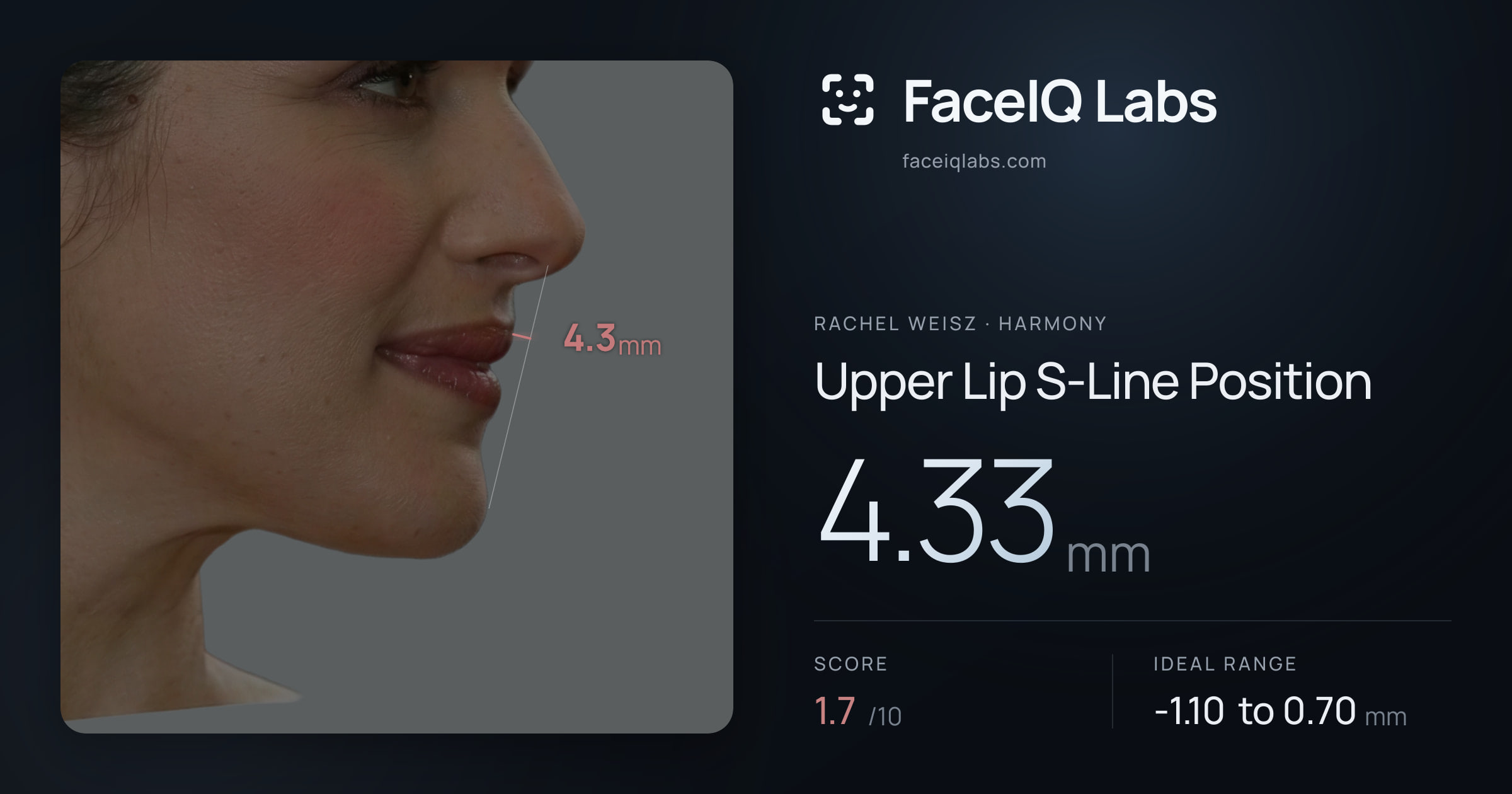 Rachel Weisz Upper Lip S-Line Position: 4.33mm, drawn on the photo
