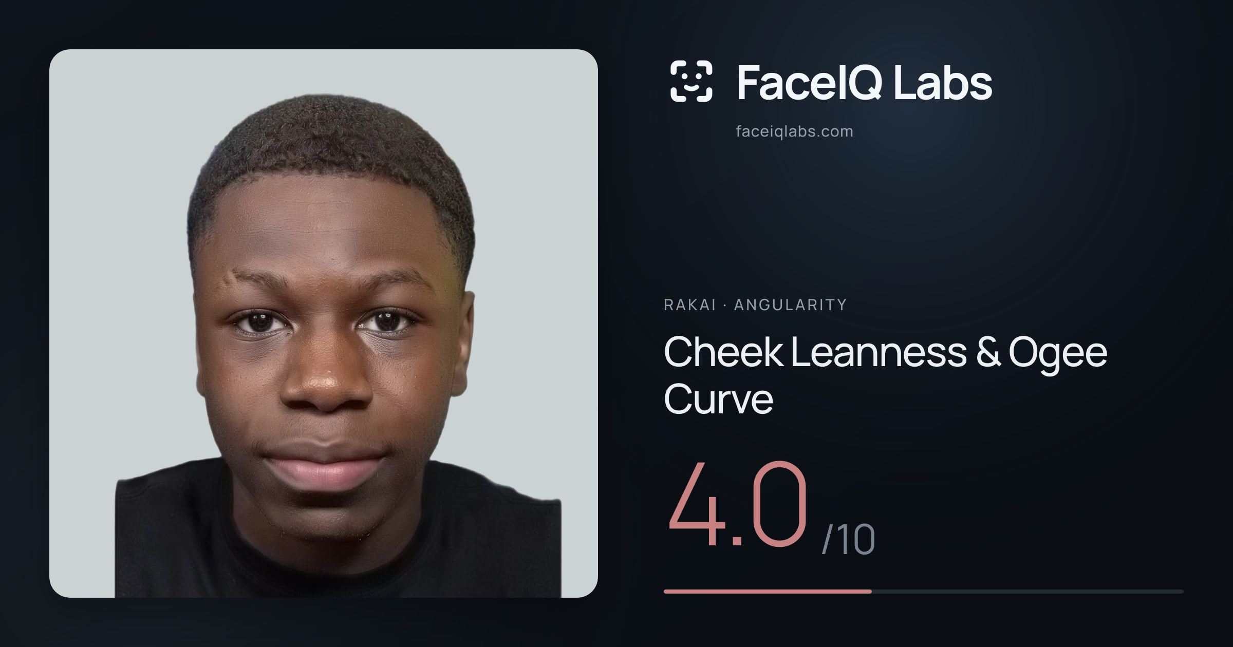Rakai Cheek Leanness & Ogee Curve: 4.0/10, drawn on the photo