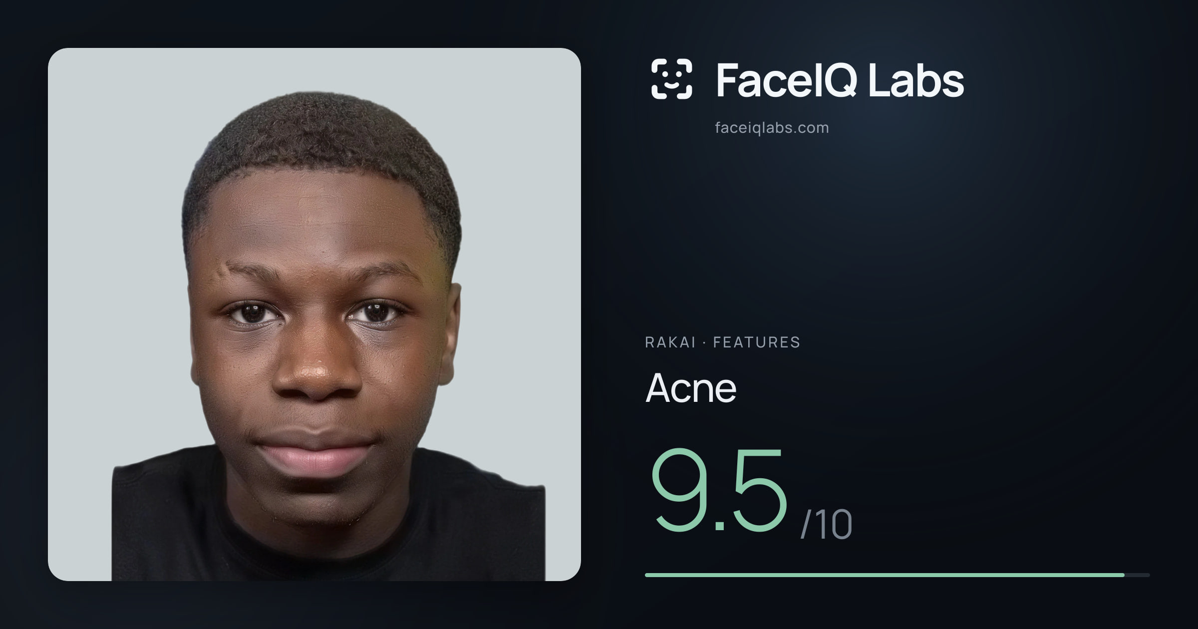 Rakai Acne: 9.5/10, drawn on the photo
