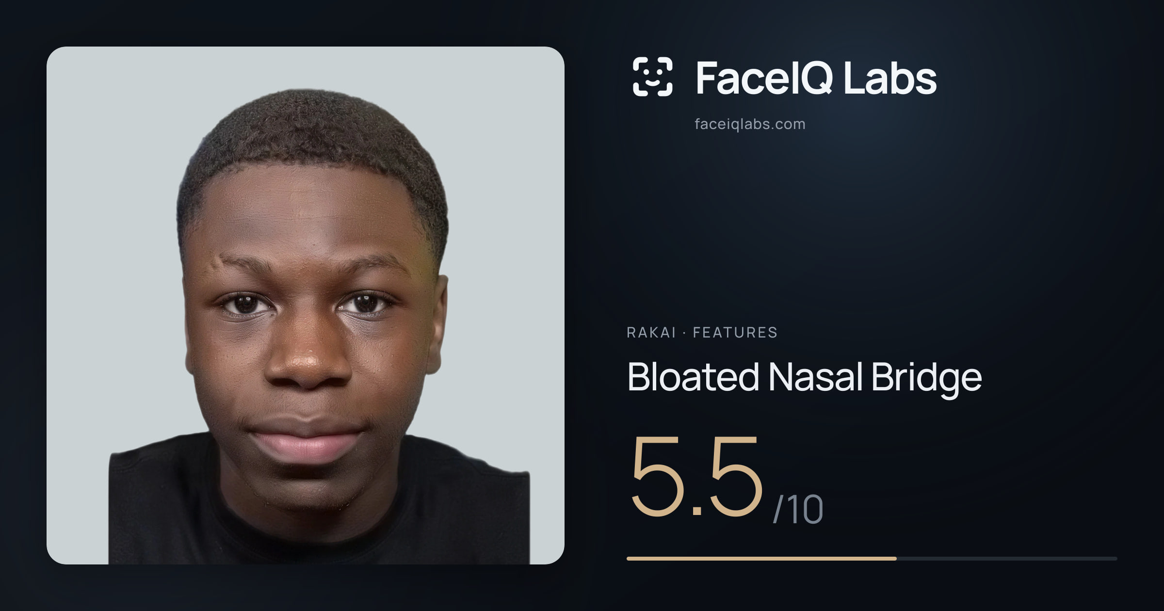 Rakai Bloated Nasal Bridge: 5.5/10, drawn on the photo