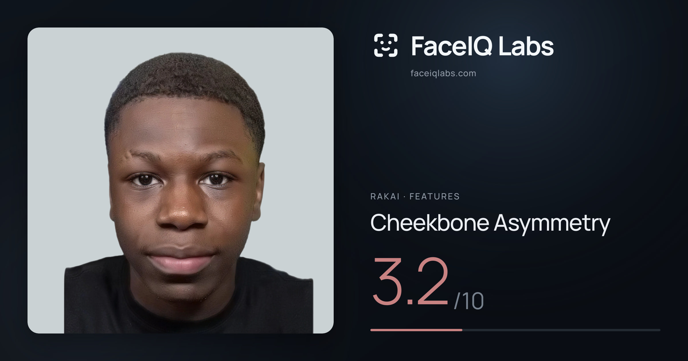 Rakai Cheekbone Asymmetry: 3.2/10, drawn on the photo