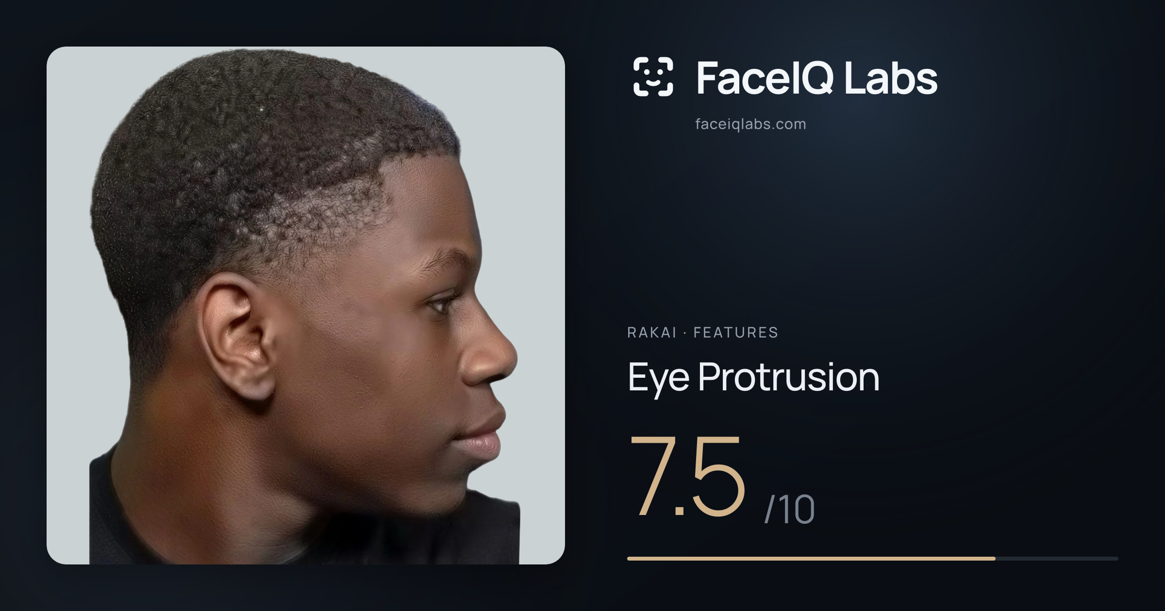 Rakai Eye Protrusion: 7.5/10, drawn on the photo