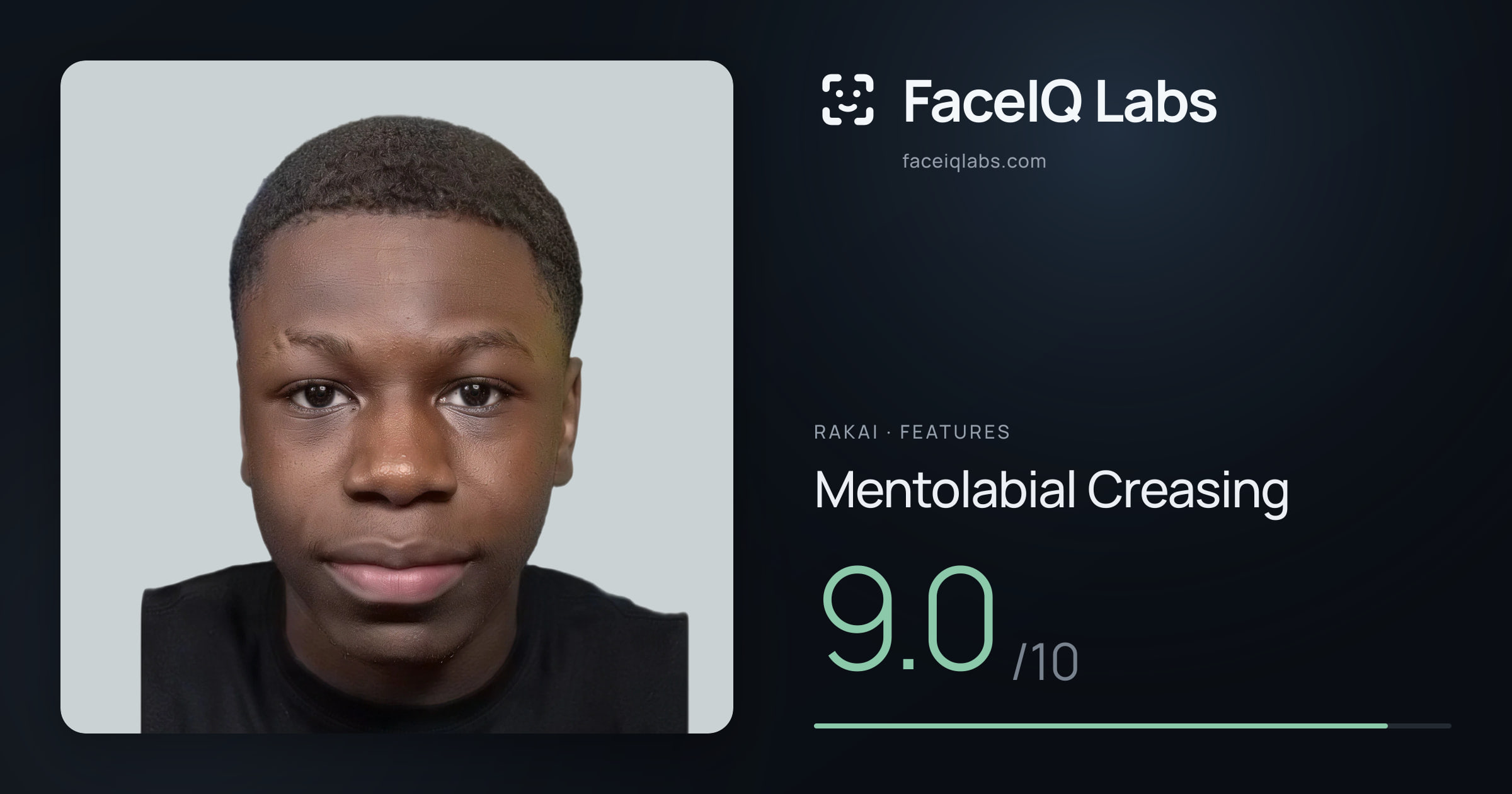 Rakai Mentolabial Creasing: 9.0/10, drawn on the photo