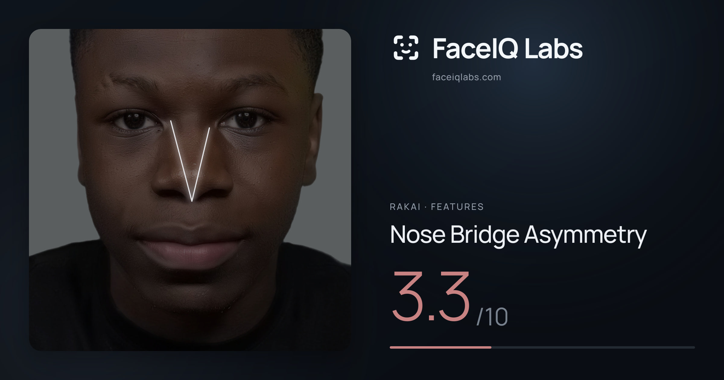 Rakai Nose Bridge Asymmetry: 3.3/10, drawn on the photo