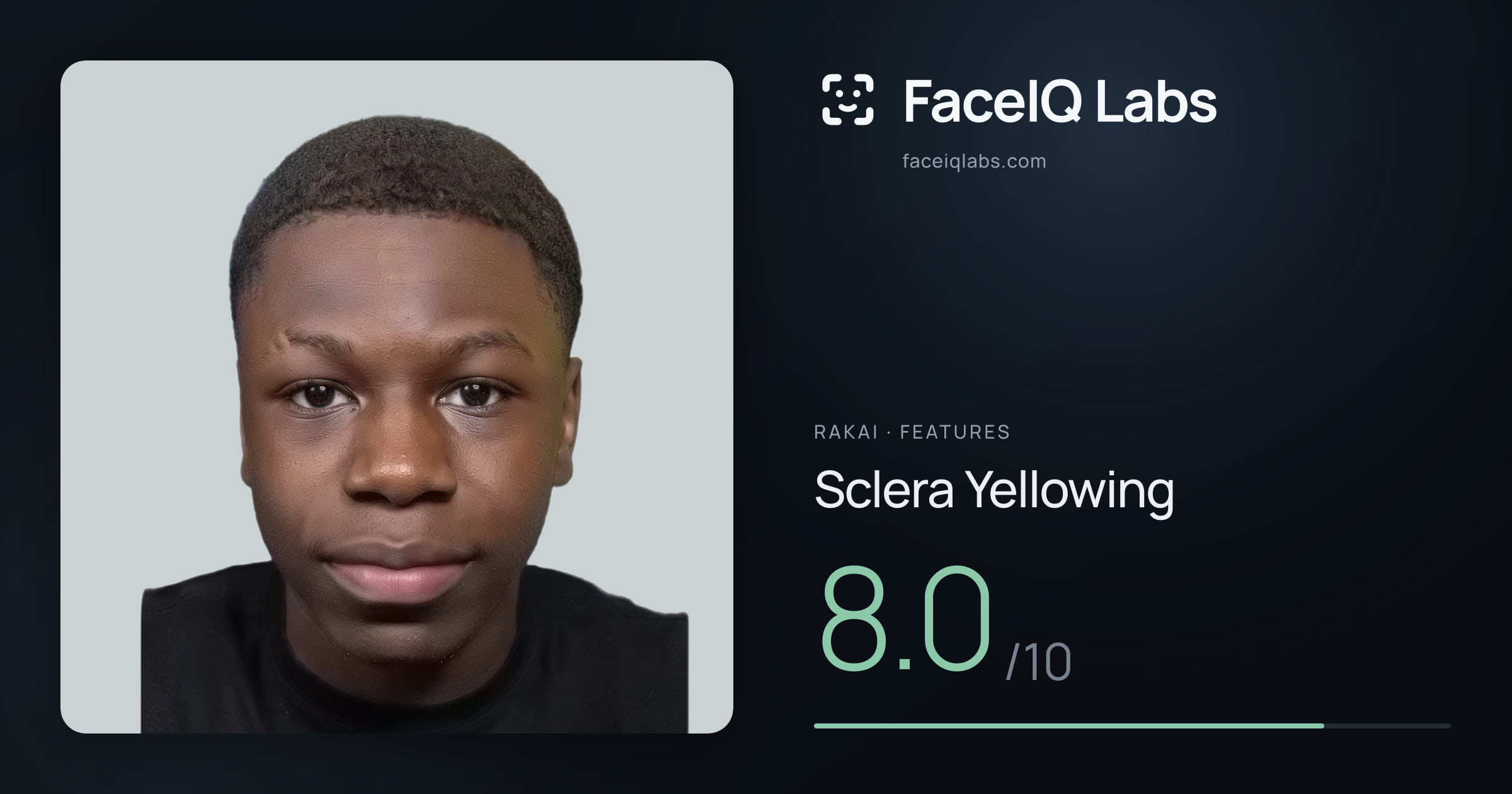 Rakai Sclera Yellowing: 8.0/10, drawn on the photo