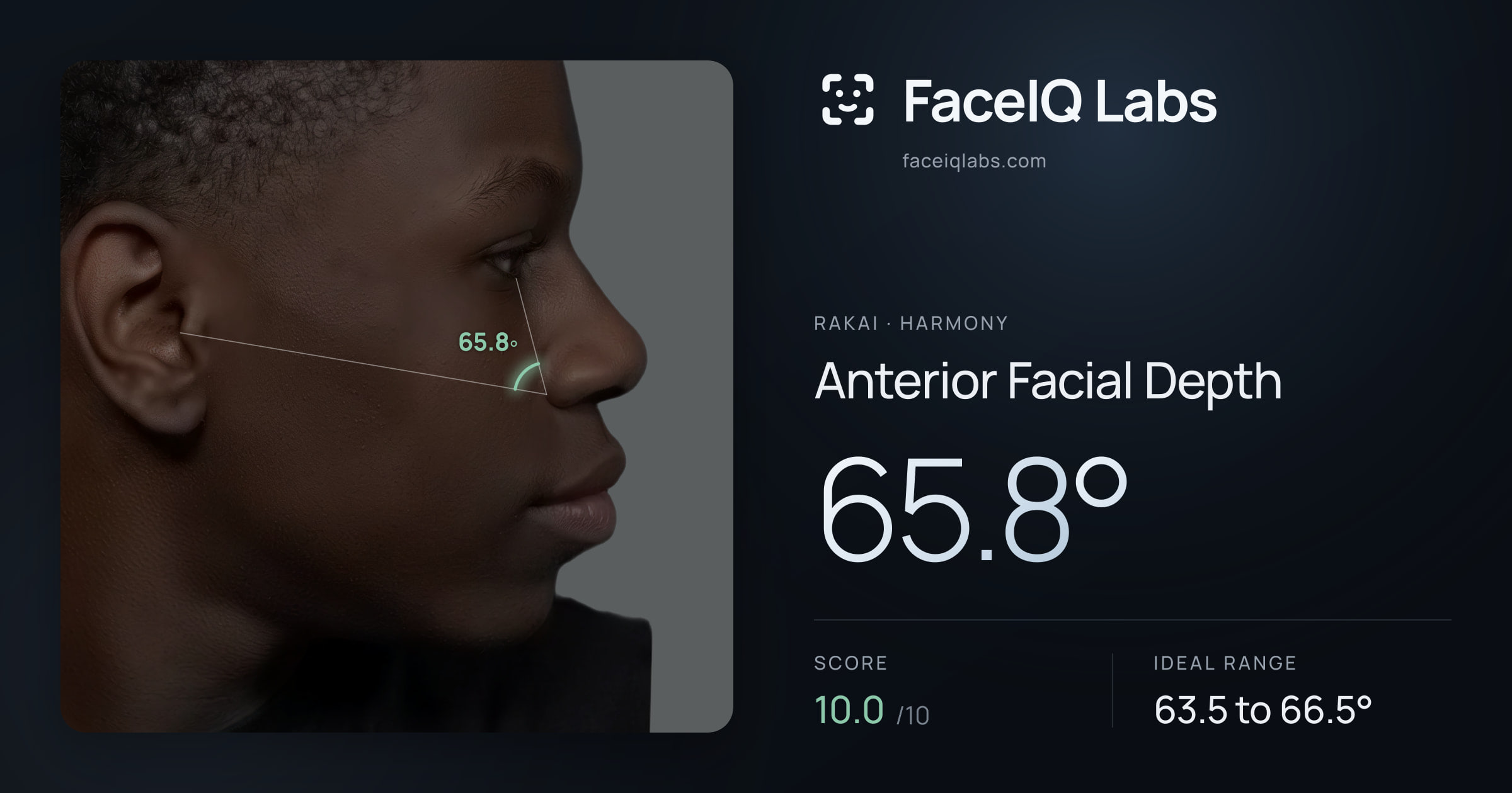 Rakai Anterior Facial Depth: 65.8°, drawn on the photo