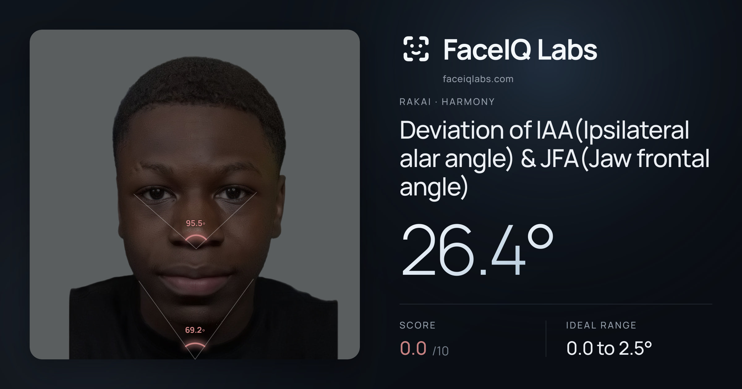 Rakai Deviation of IAA(Ipsilateral alar angle) & JFA(Jaw frontal angle): 26.4°, drawn on the photo