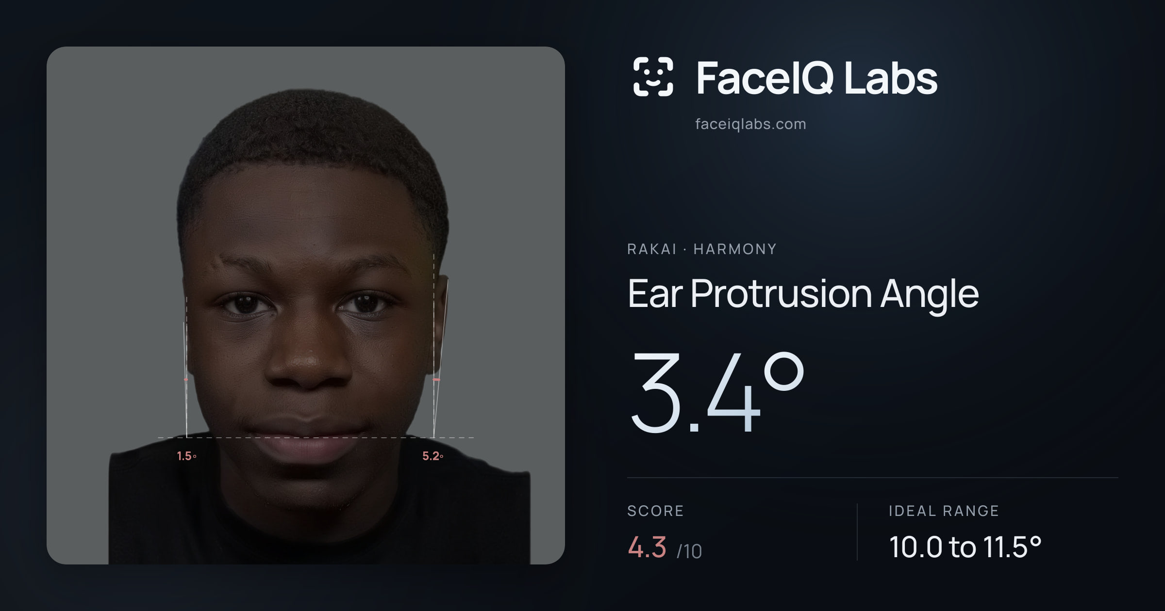 Rakai Ear Protrusion Angle: 3.4°, drawn on the photo