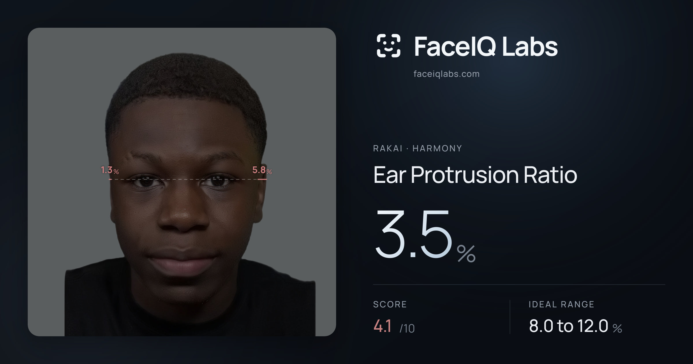 Rakai Ear Protrusion Ratio: 3.5%, drawn on the photo