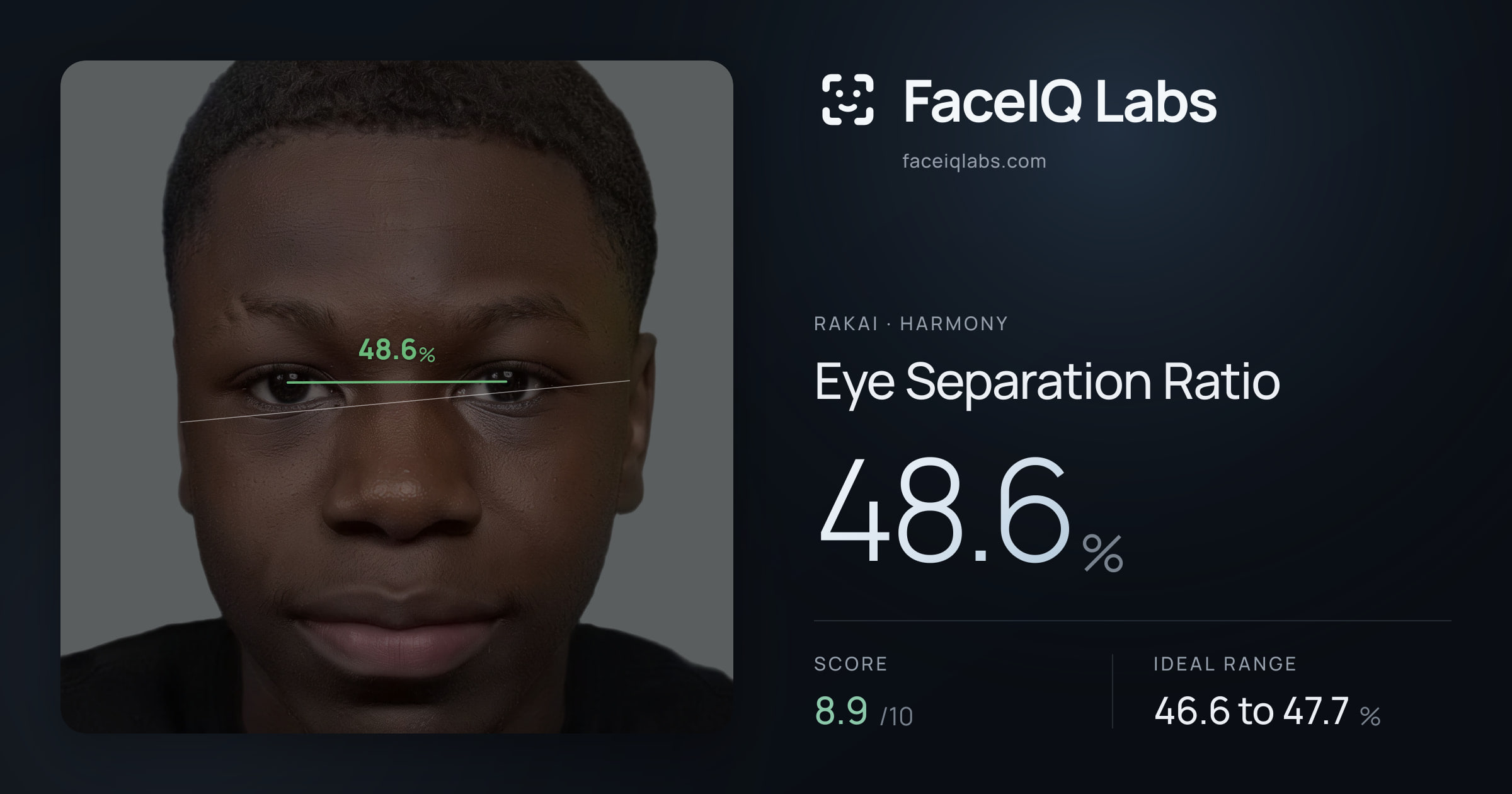 Rakai Eye Separation Ratio: 48.6%, drawn on the photo
