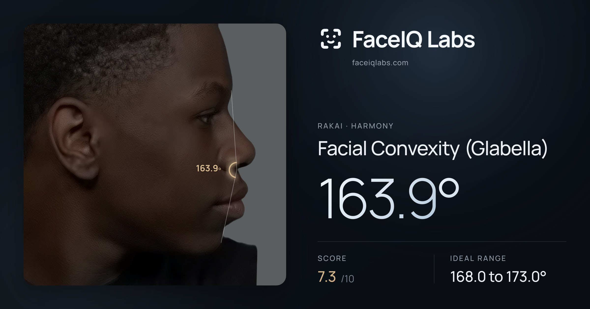 Rakai Facial Convexity (Glabella): 163.9°, drawn on the photo