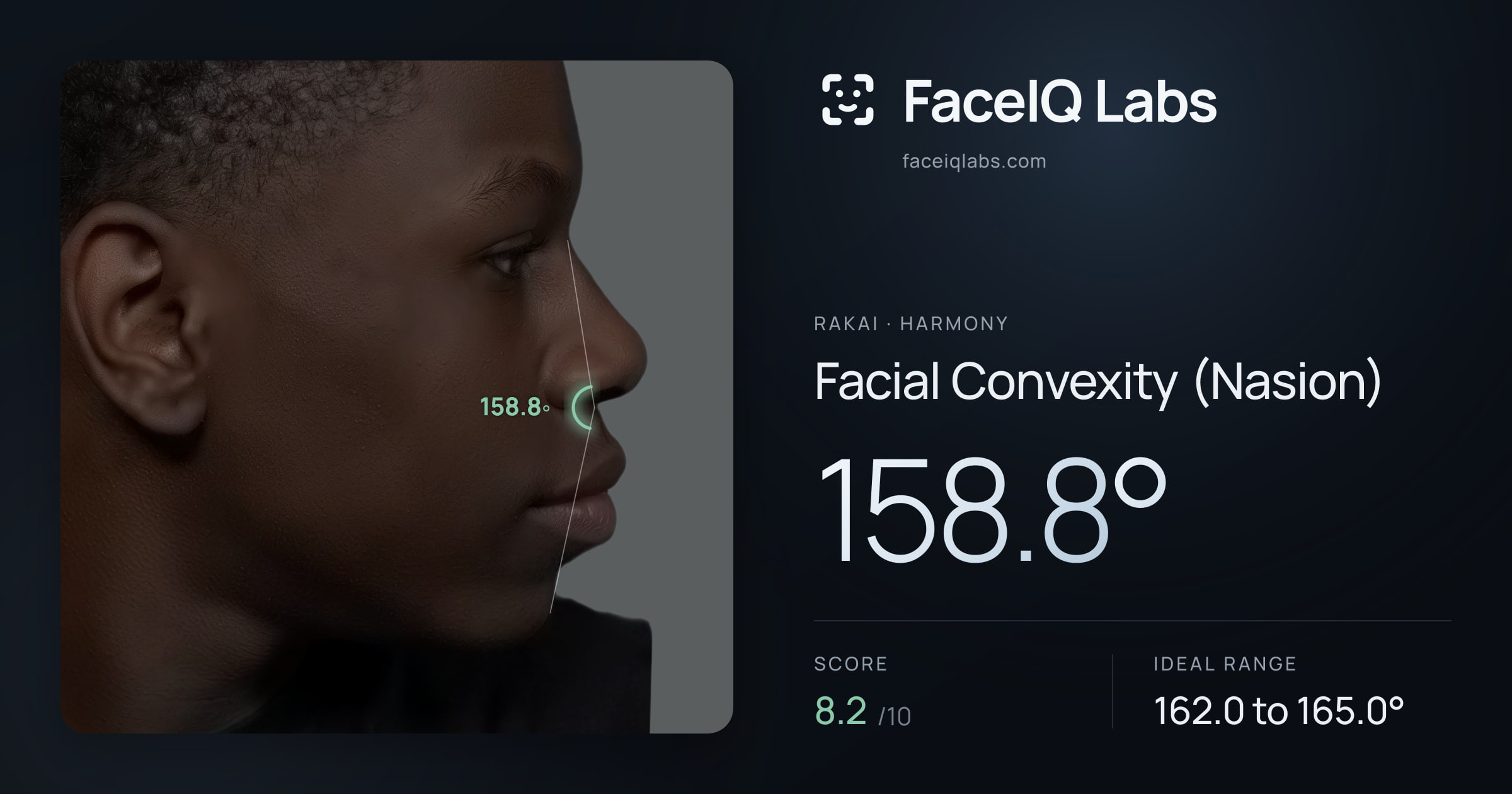 Rakai Facial Convexity (Nasion): 158.8°, drawn on the photo