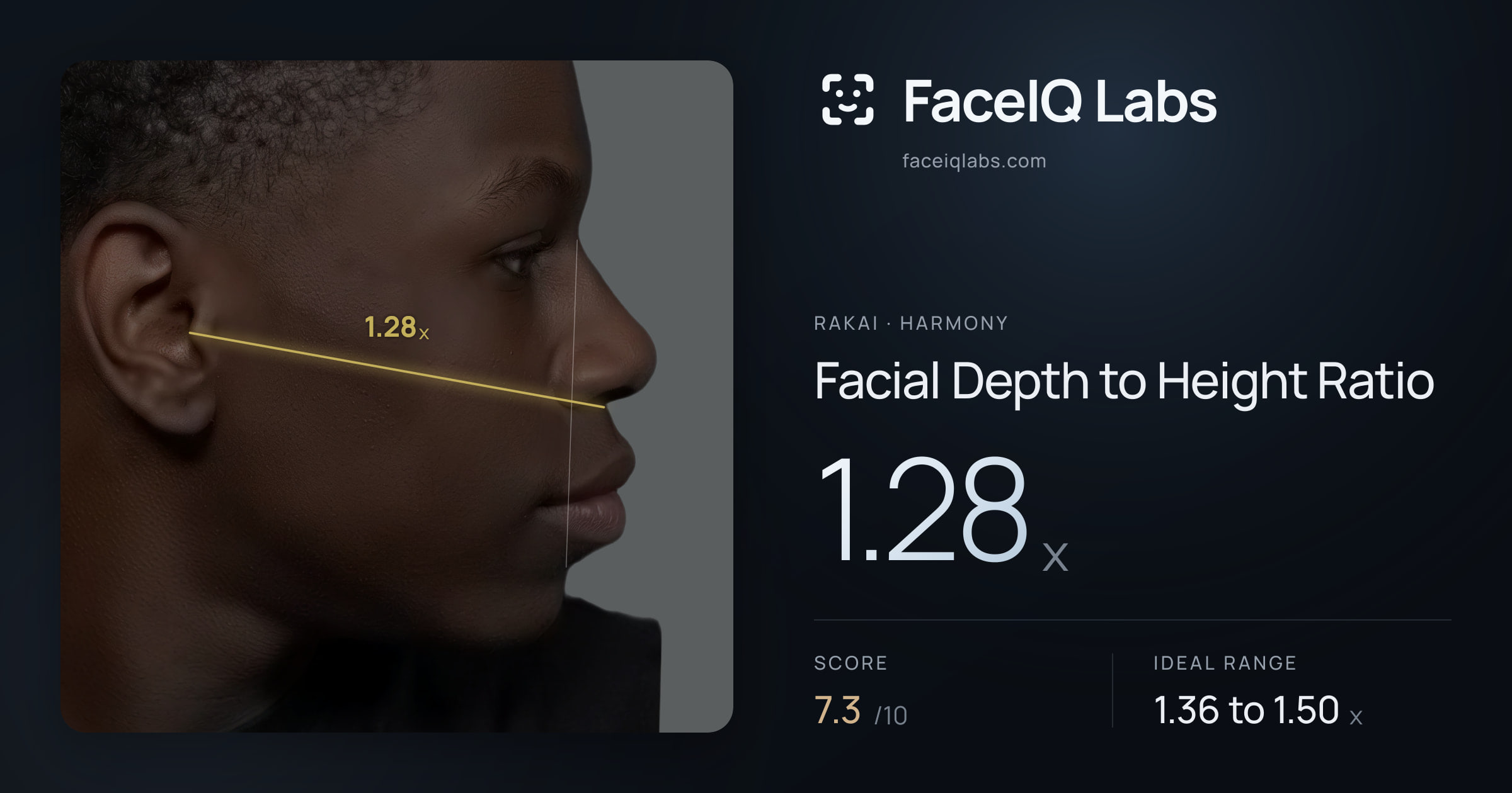 Rakai Facial Depth to Height Ratio: 1.28x, drawn on the photo
