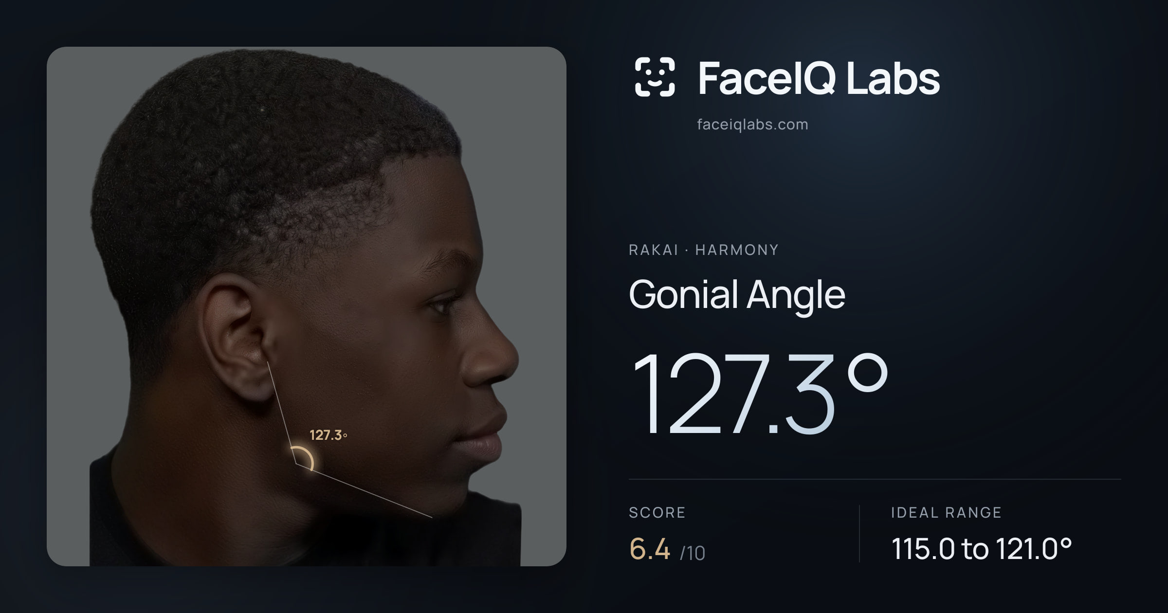 Rakai Gonial Angle: 127.3°, drawn on the photo